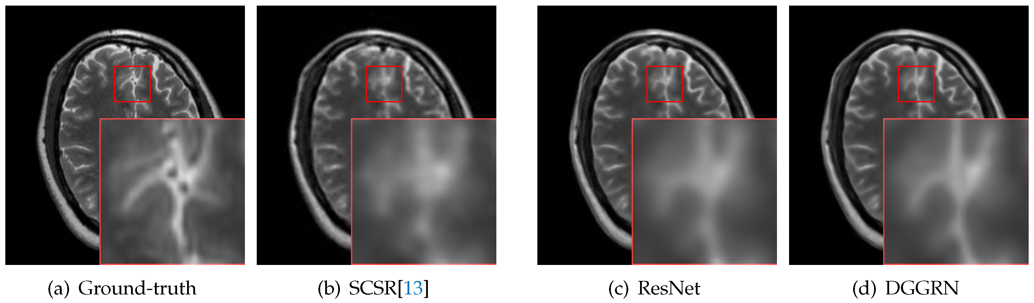 Applsci 09 04874 g001