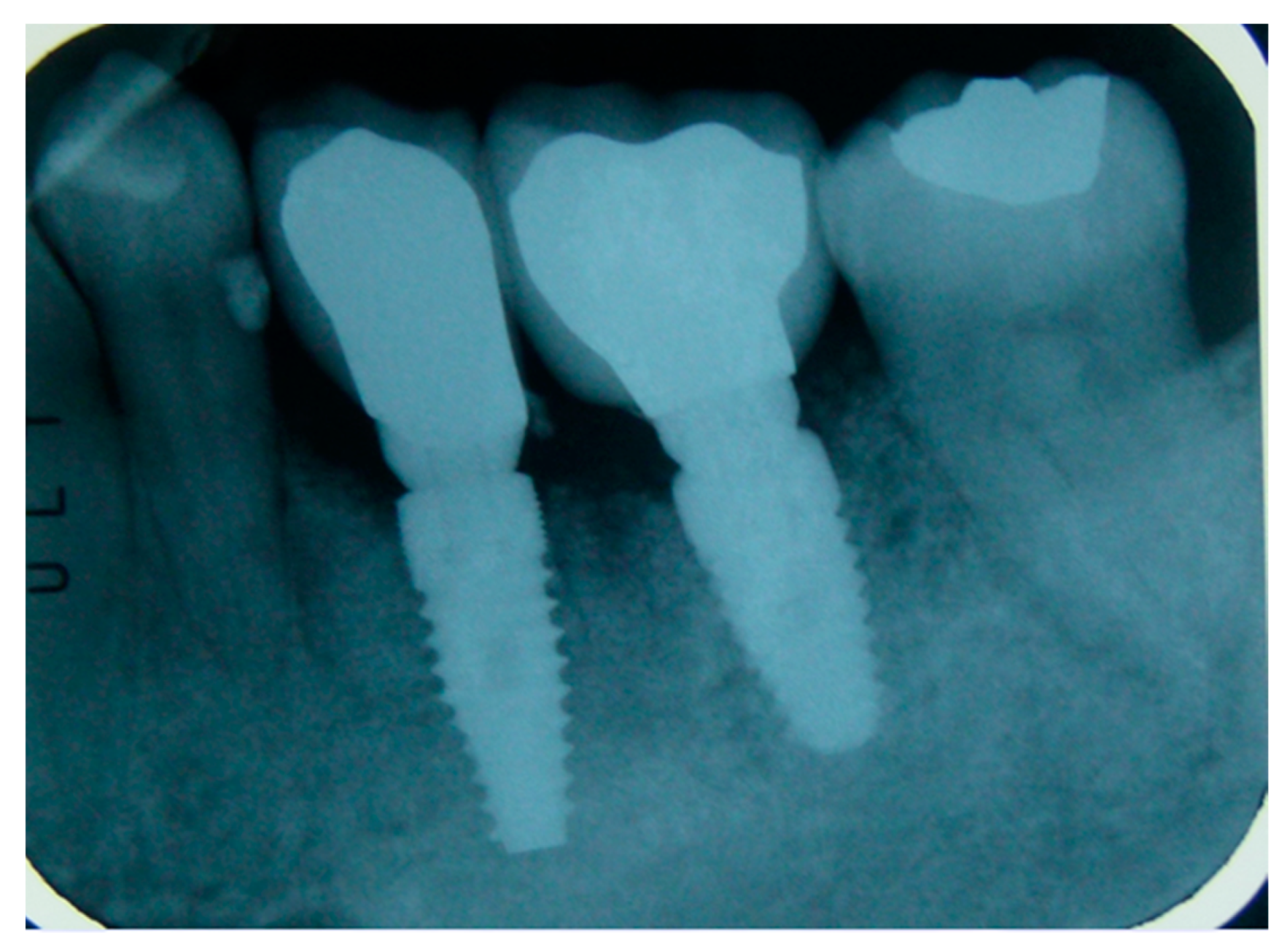 Applsci 09 05396 g005