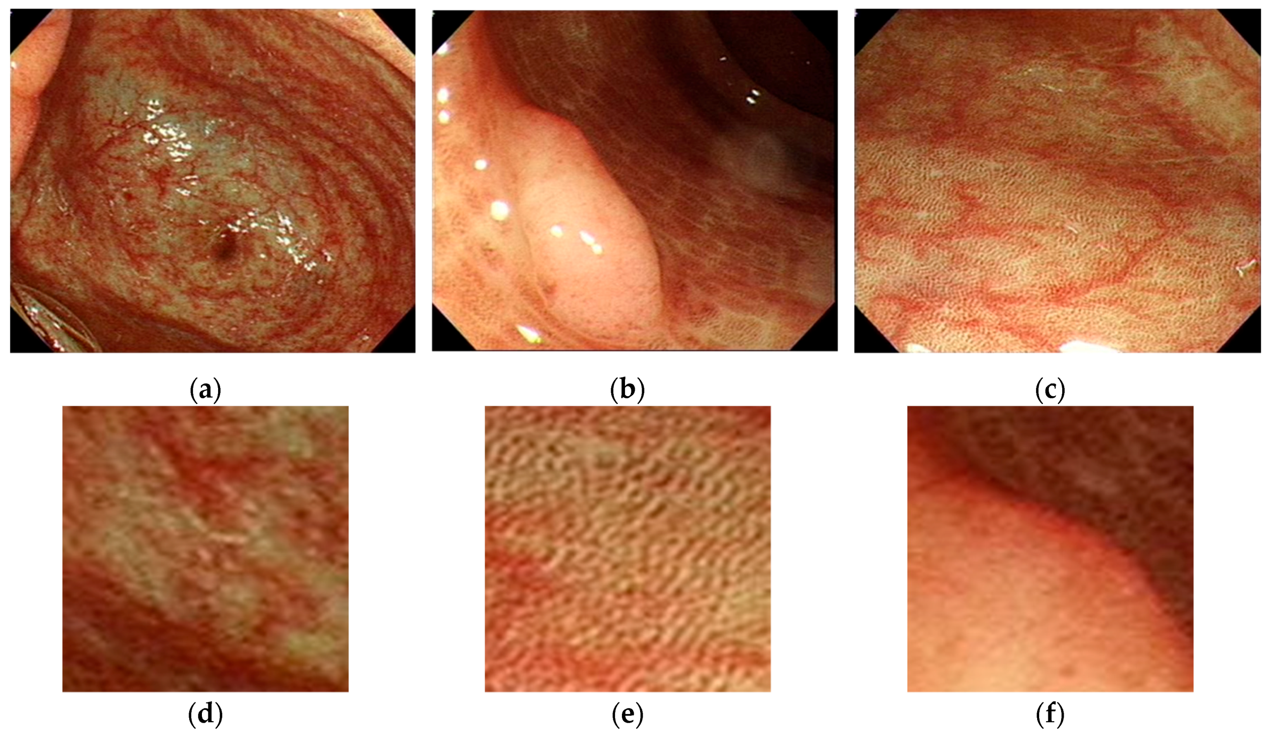 Applsci 10 00404 g002
