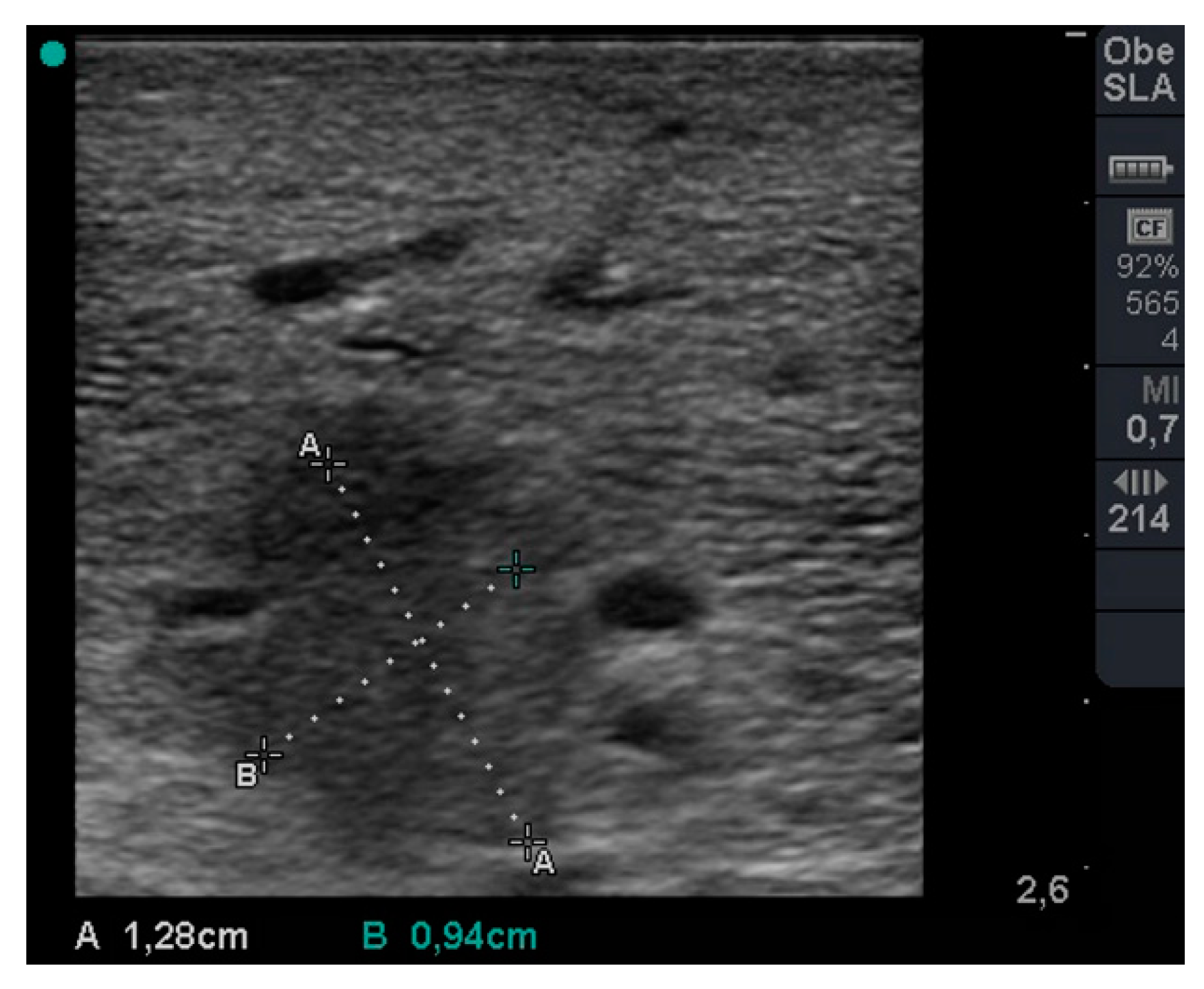 Applsci 10 00574 g006
