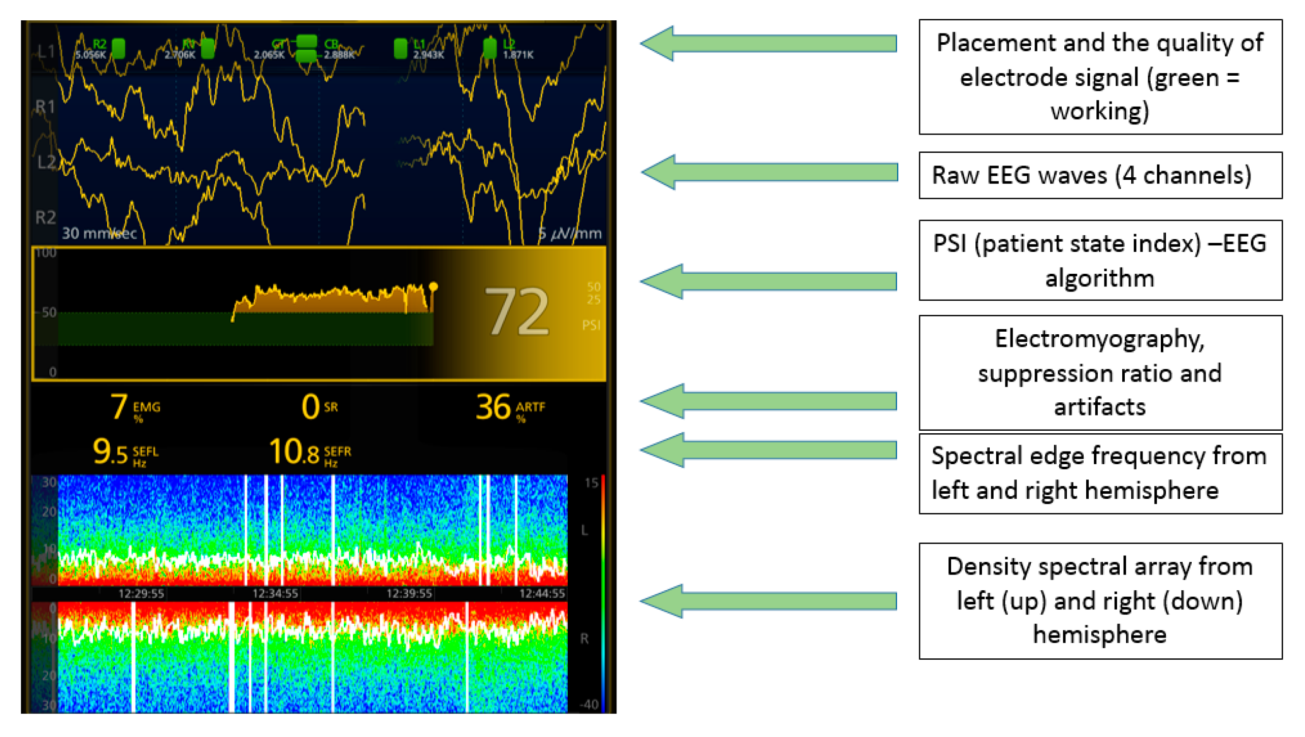 Applsci 10 01050 g003