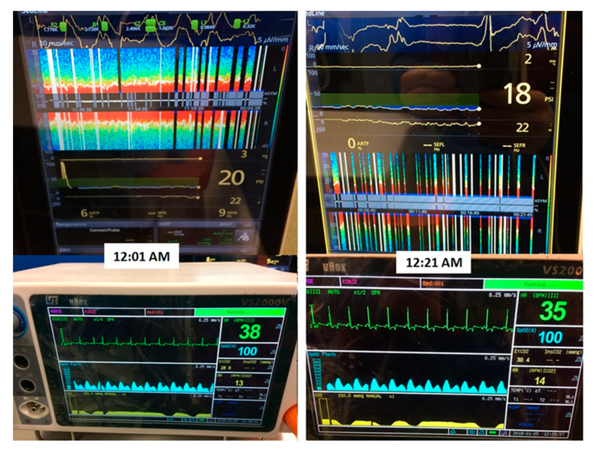 Applsci 10 01050 g004