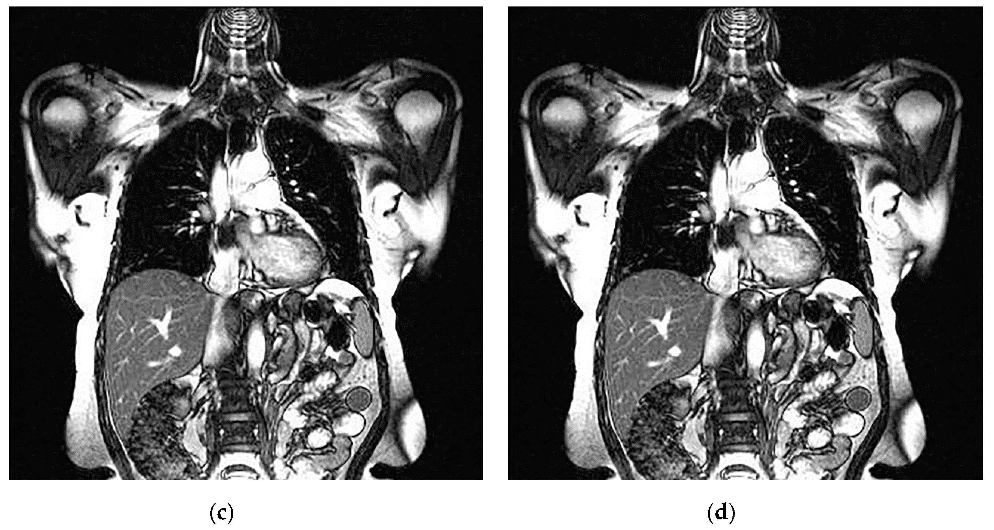 Applsci 10 01223 g006b Applsci 10 01223 g006b