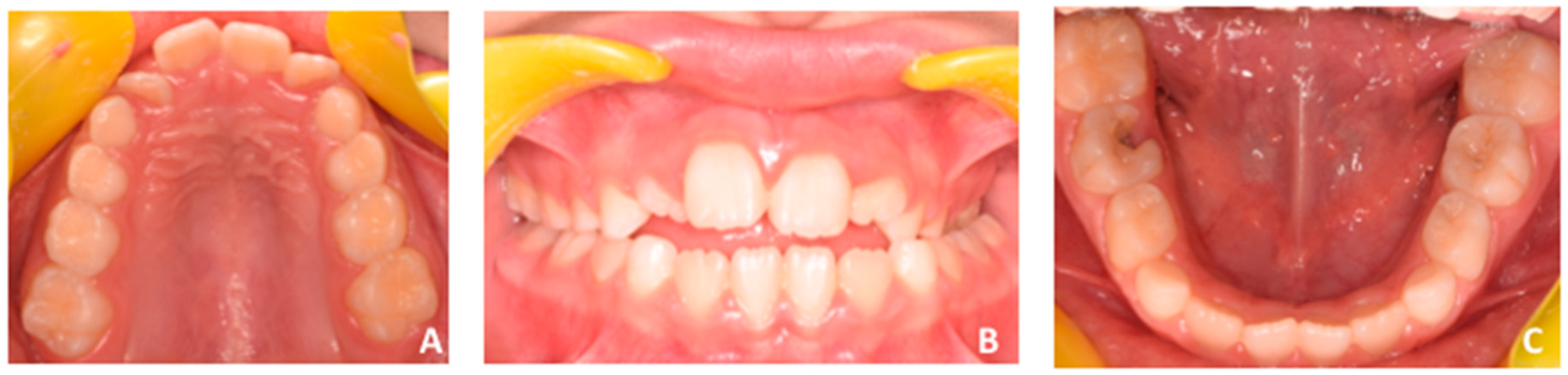 Applsci 10 01495 g002 Applsci 10 01495 g002