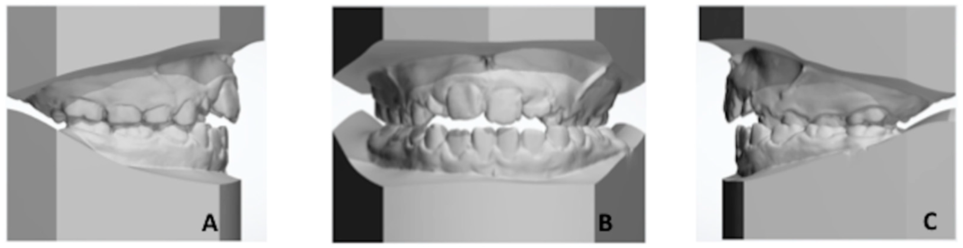 Applsci 10 01495 g003 Applsci 10 01495 g003