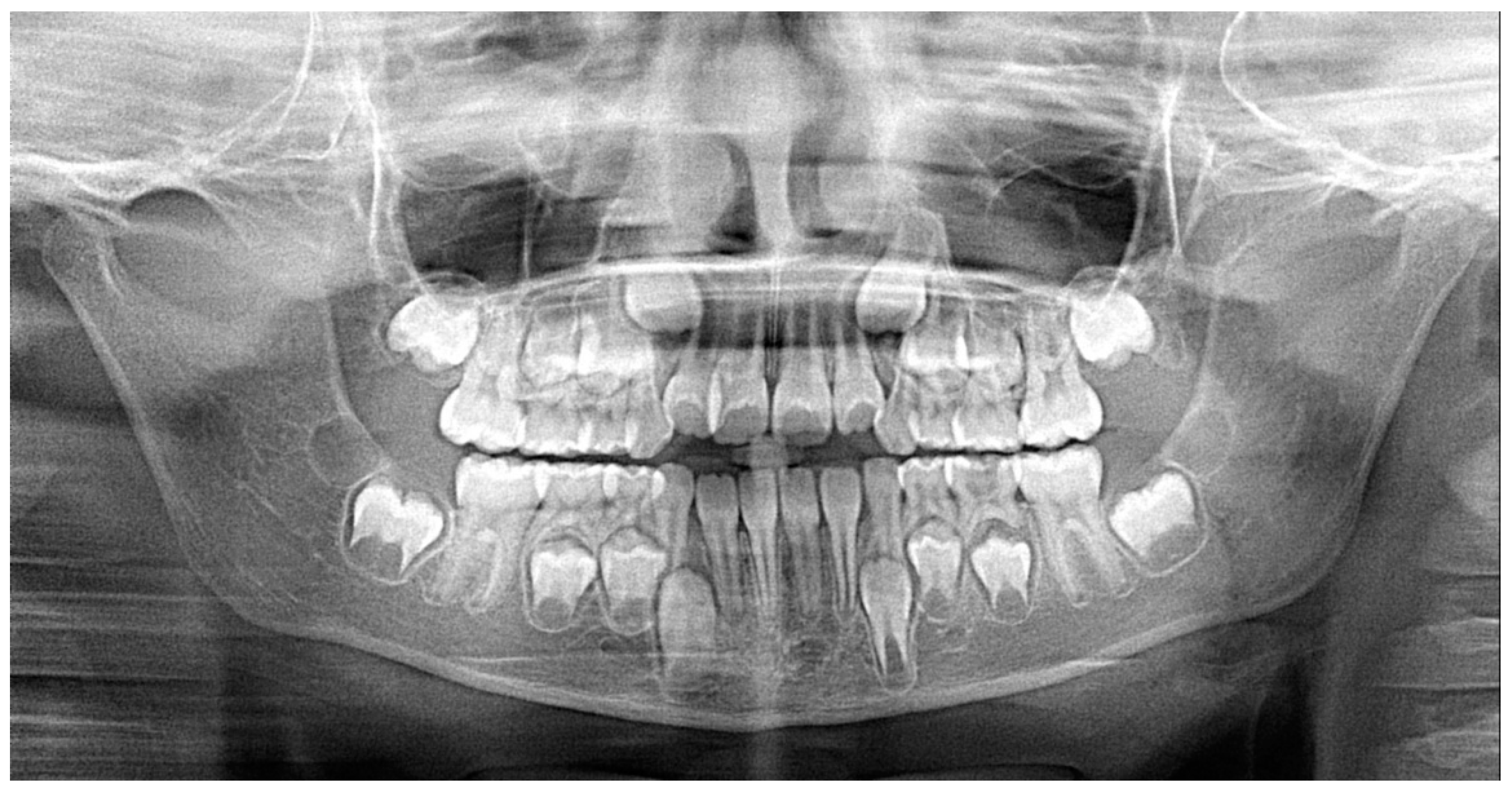 Applsci 10 01495 g005 Applsci 10 01495 g005