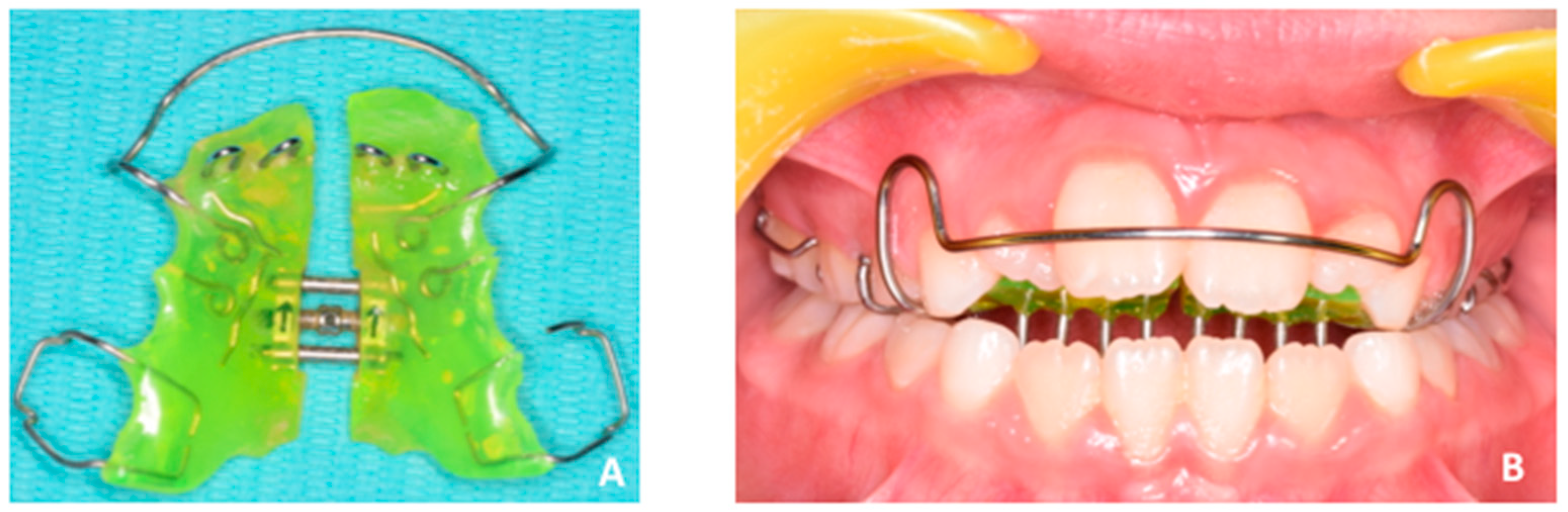 Applsci 10 01495 g010 Applsci 10 01495 g010