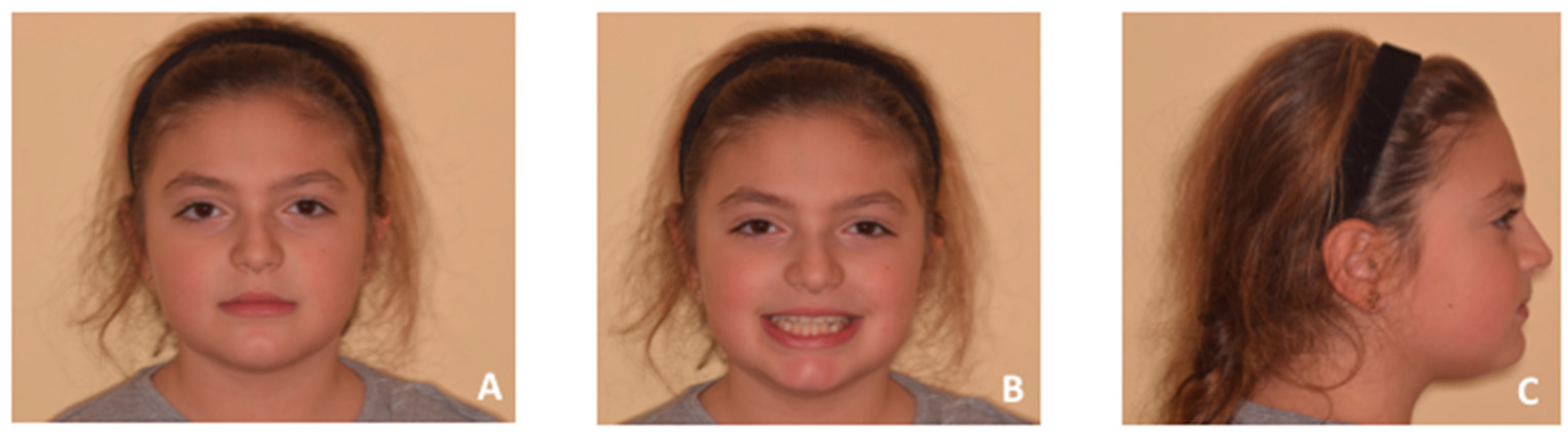 Applsci 10 01495 g011 Applsci 10 01495 g011