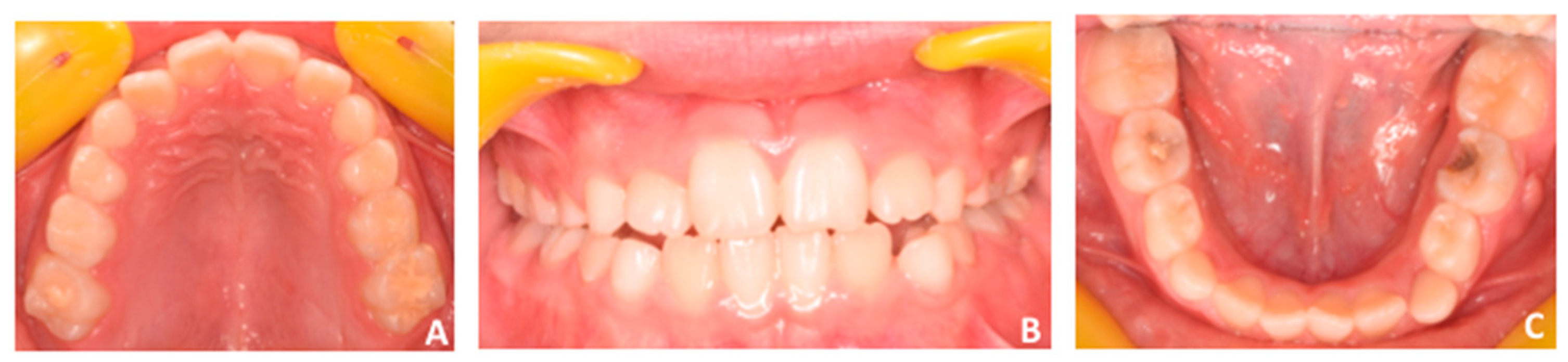 Applsci 10 01495 g012 Applsci 10 01495 g012