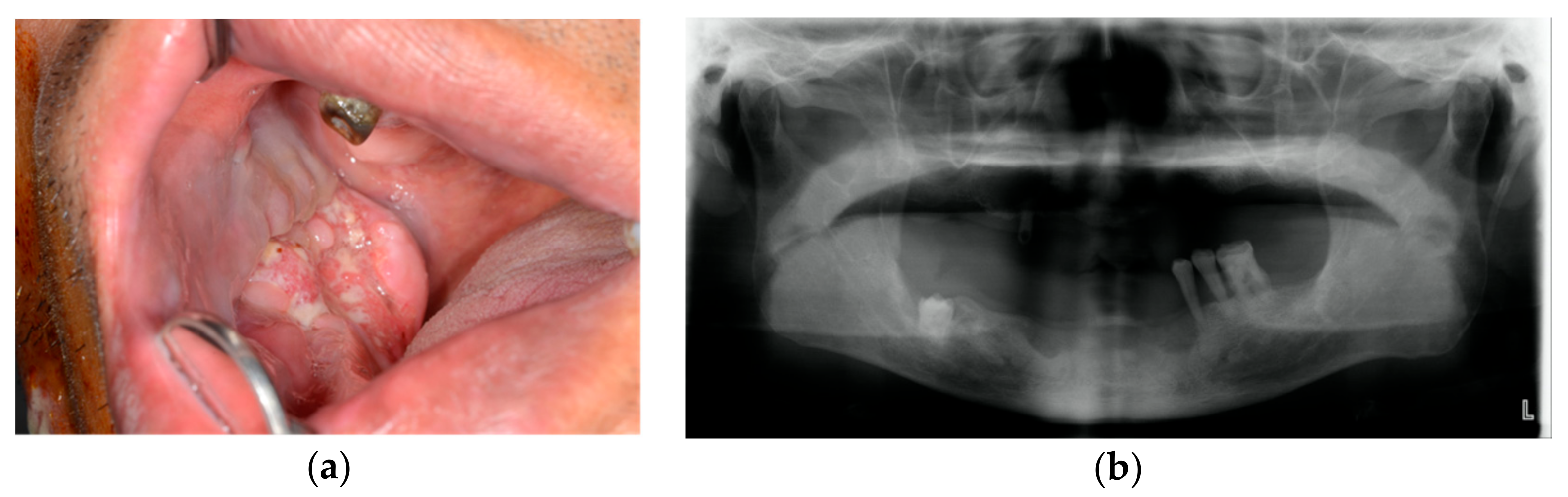 Applsci 10 01587 g001