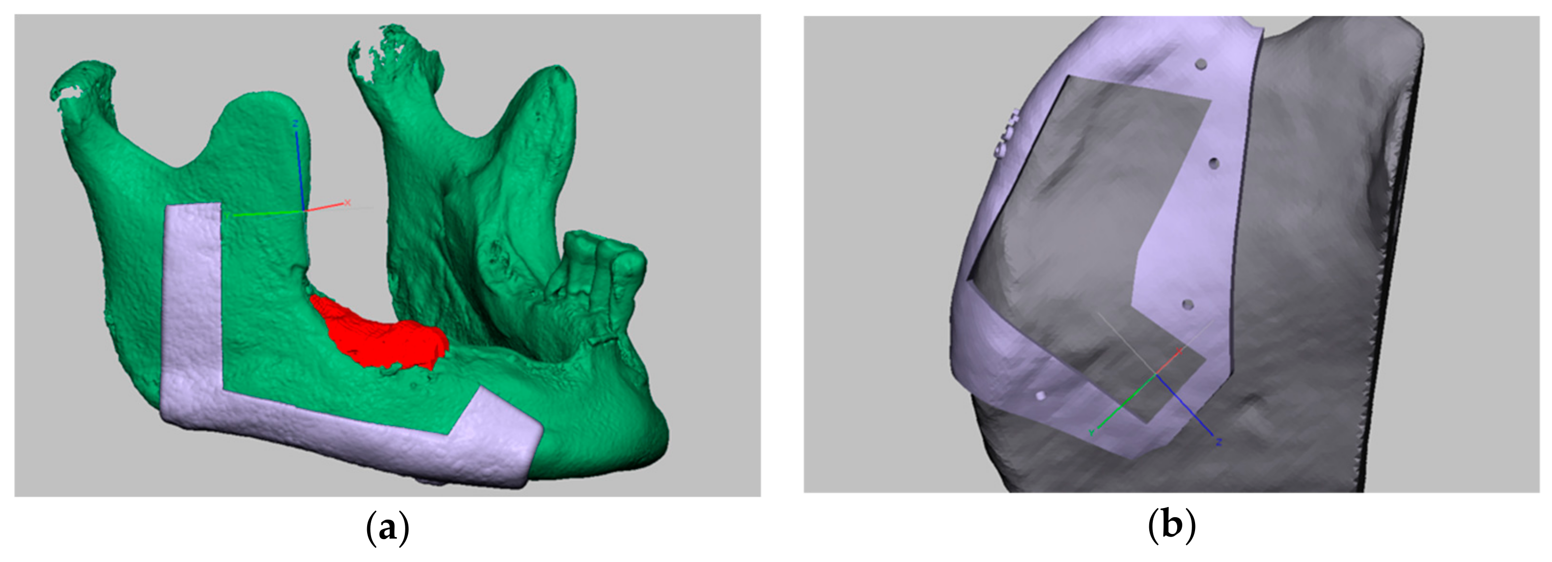 Applsci 10 01587 g002