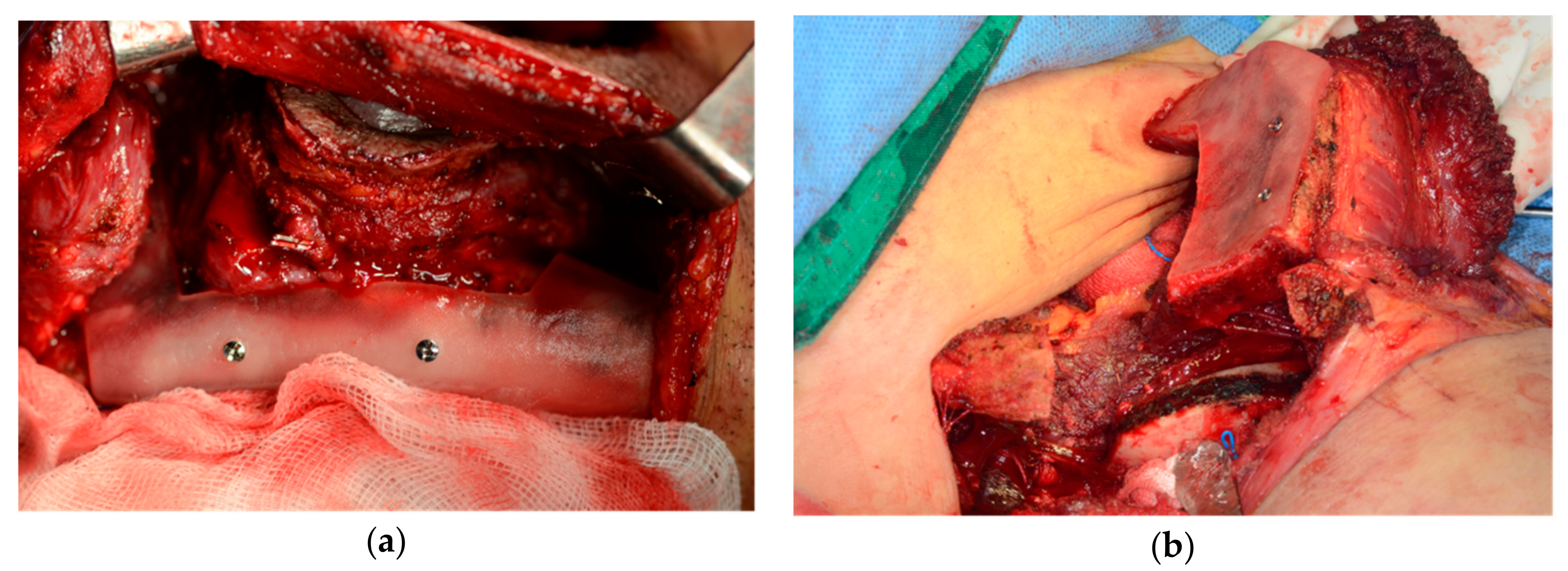 Applsci 10 01587 g003