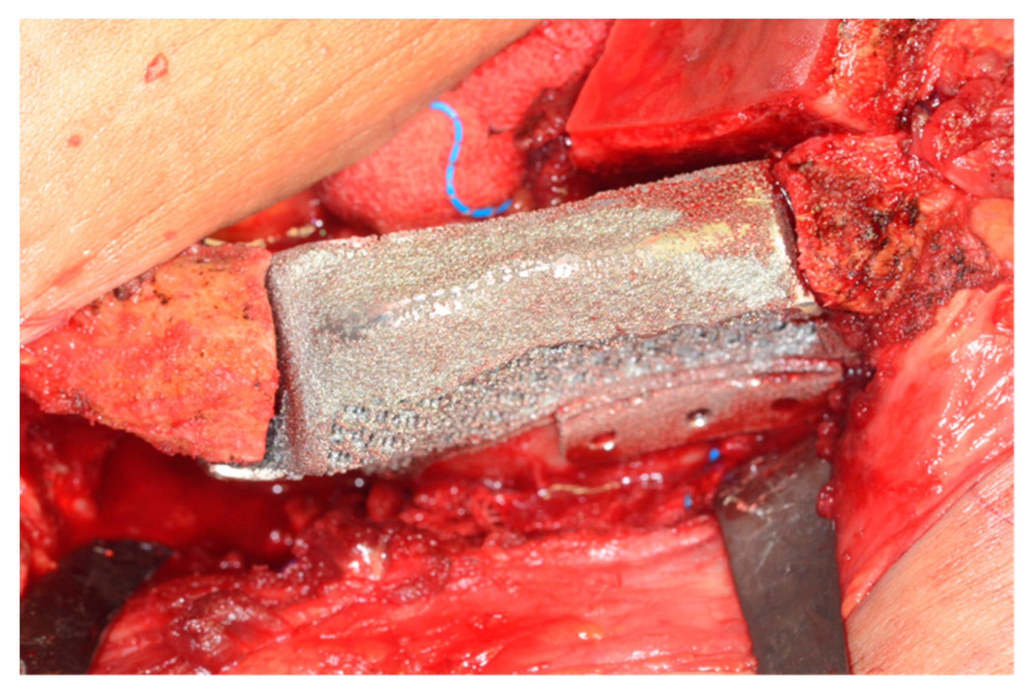 Applsci 10 01587 g004