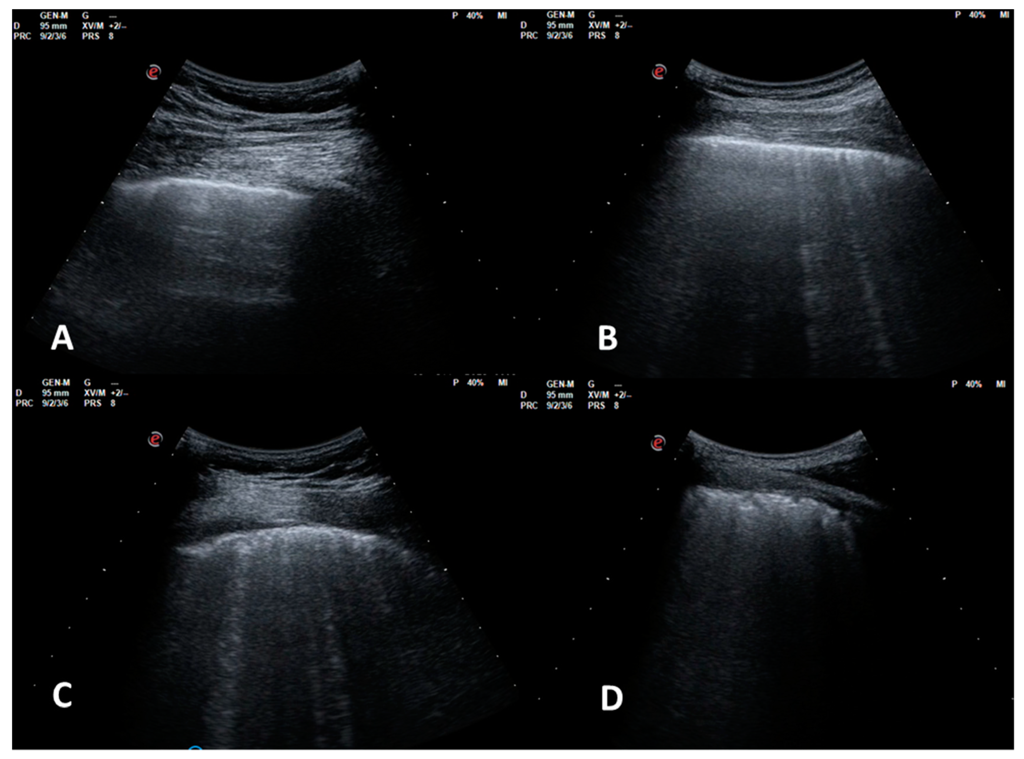 Applsci 10 01617 g001