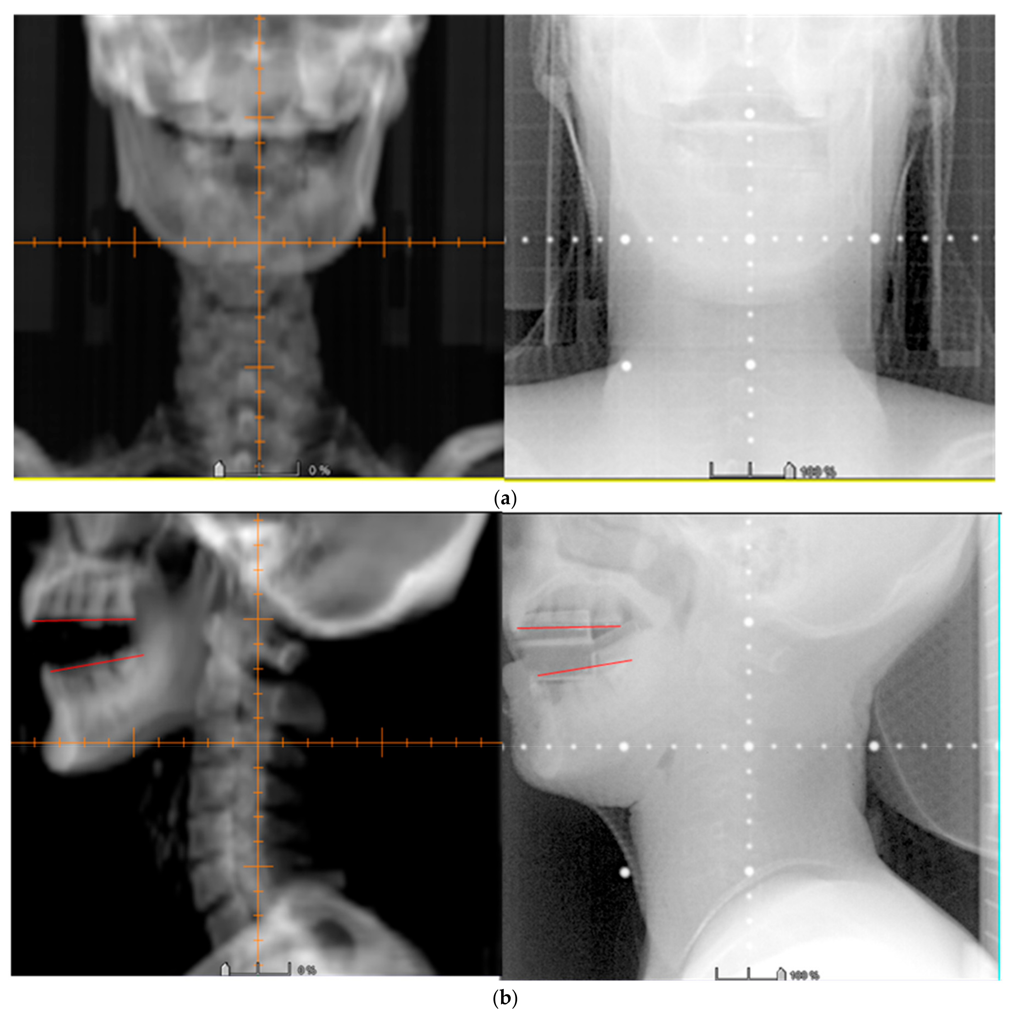 Applsci 10 01688 g006