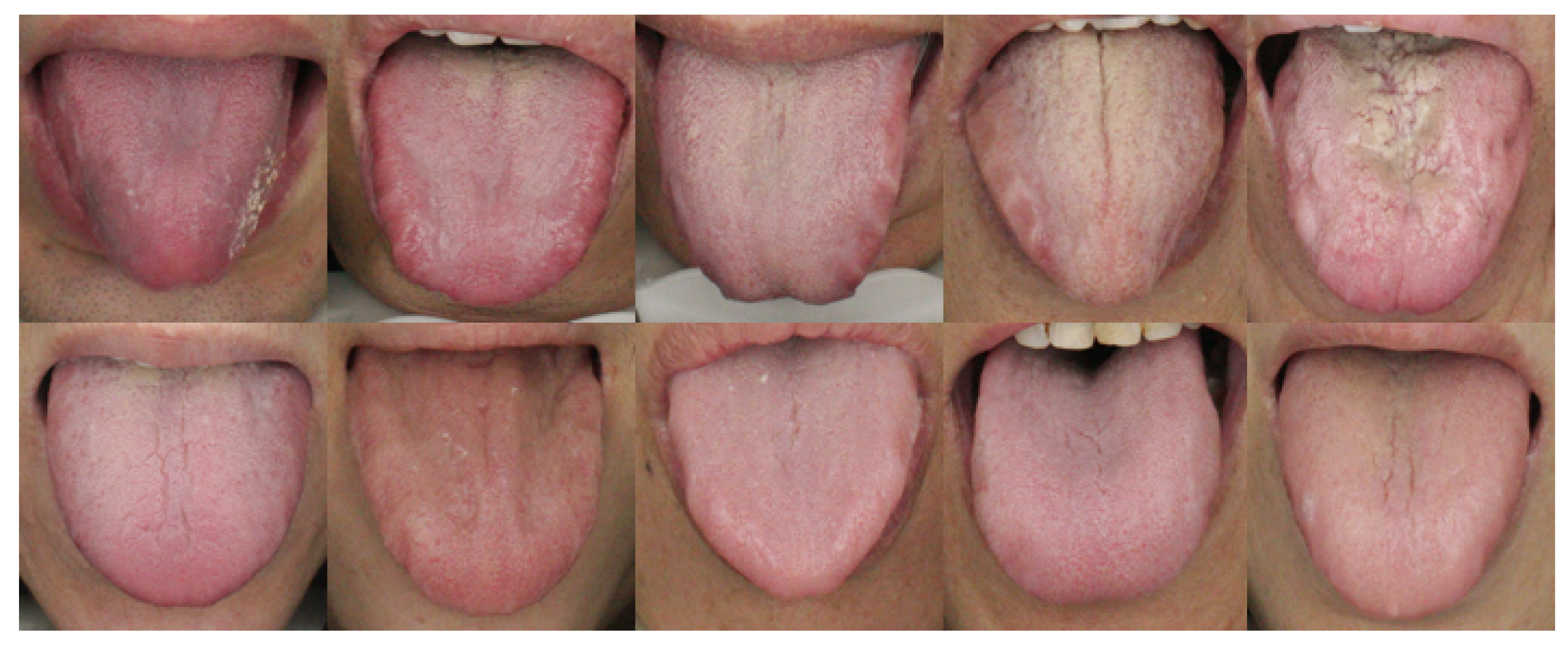 Applsci 10 01784 g011