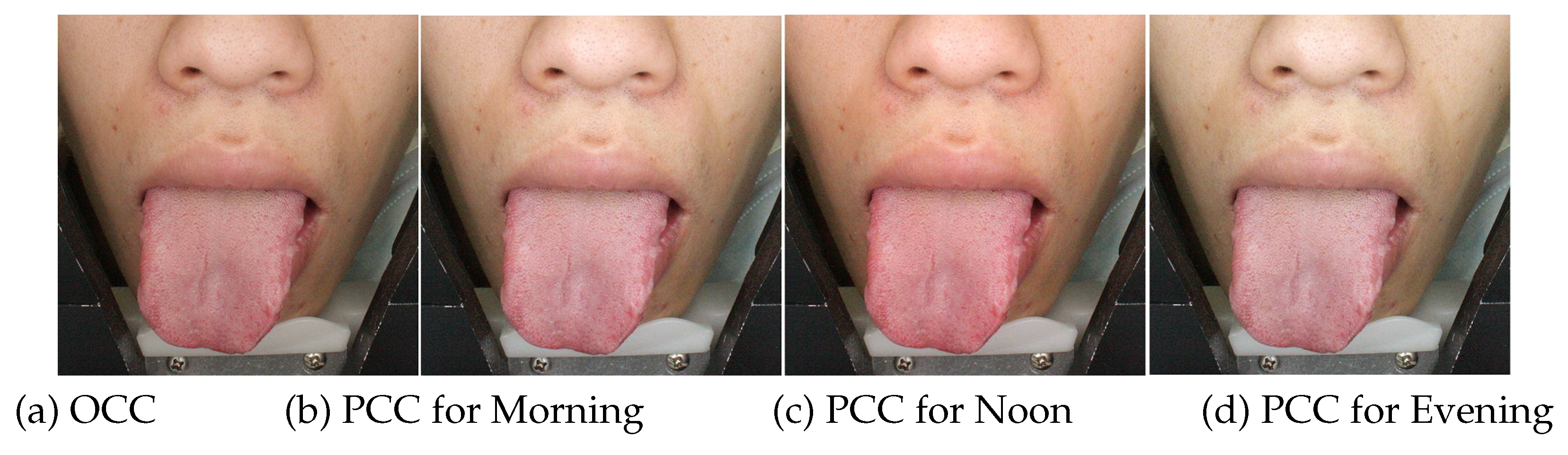 Applsci 10 01784 g015