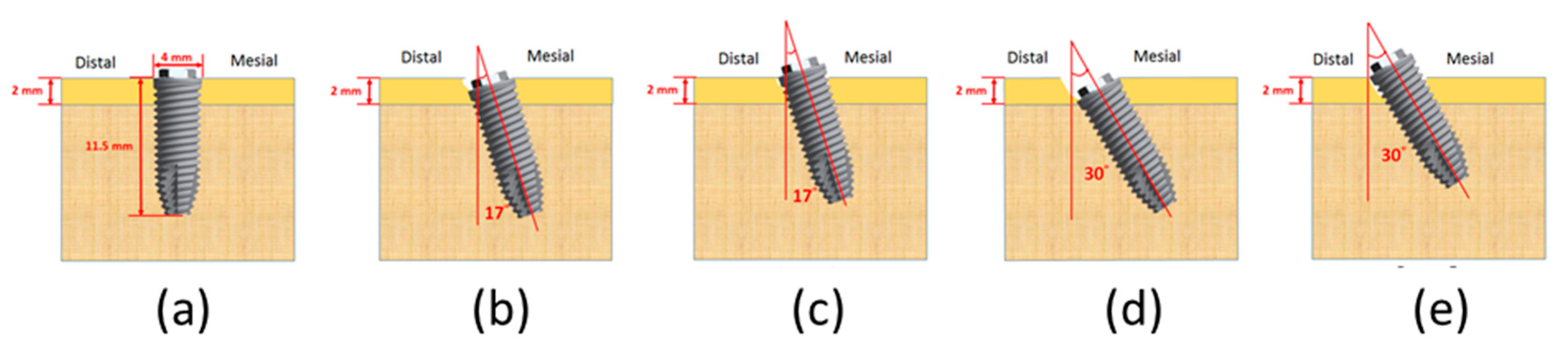Applsci 10 03112 g002