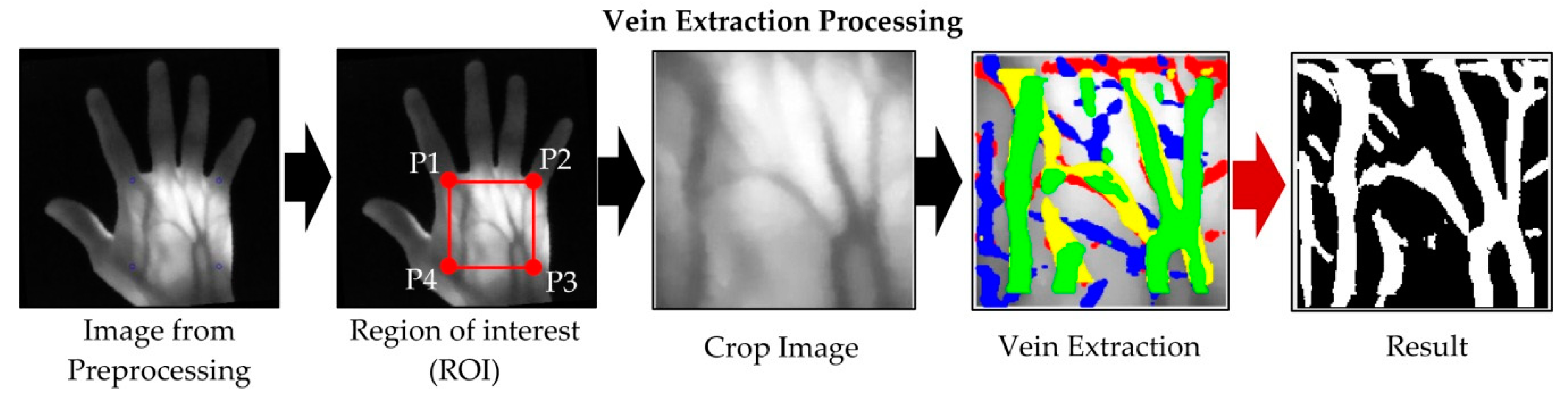 Applsci 10 03192 g007 Applsci 10 03192 g007
