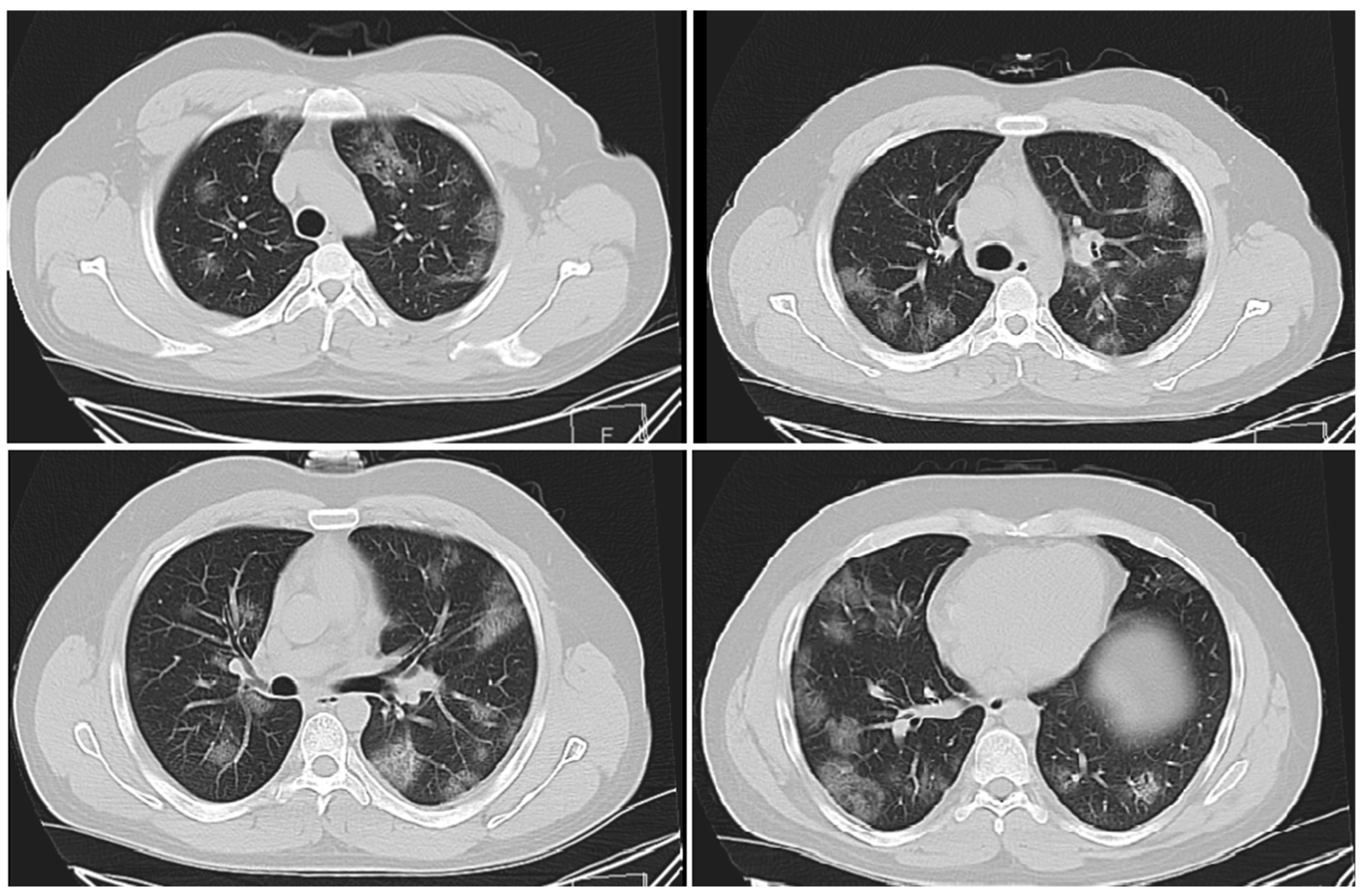 Applsci 10 03641 g007