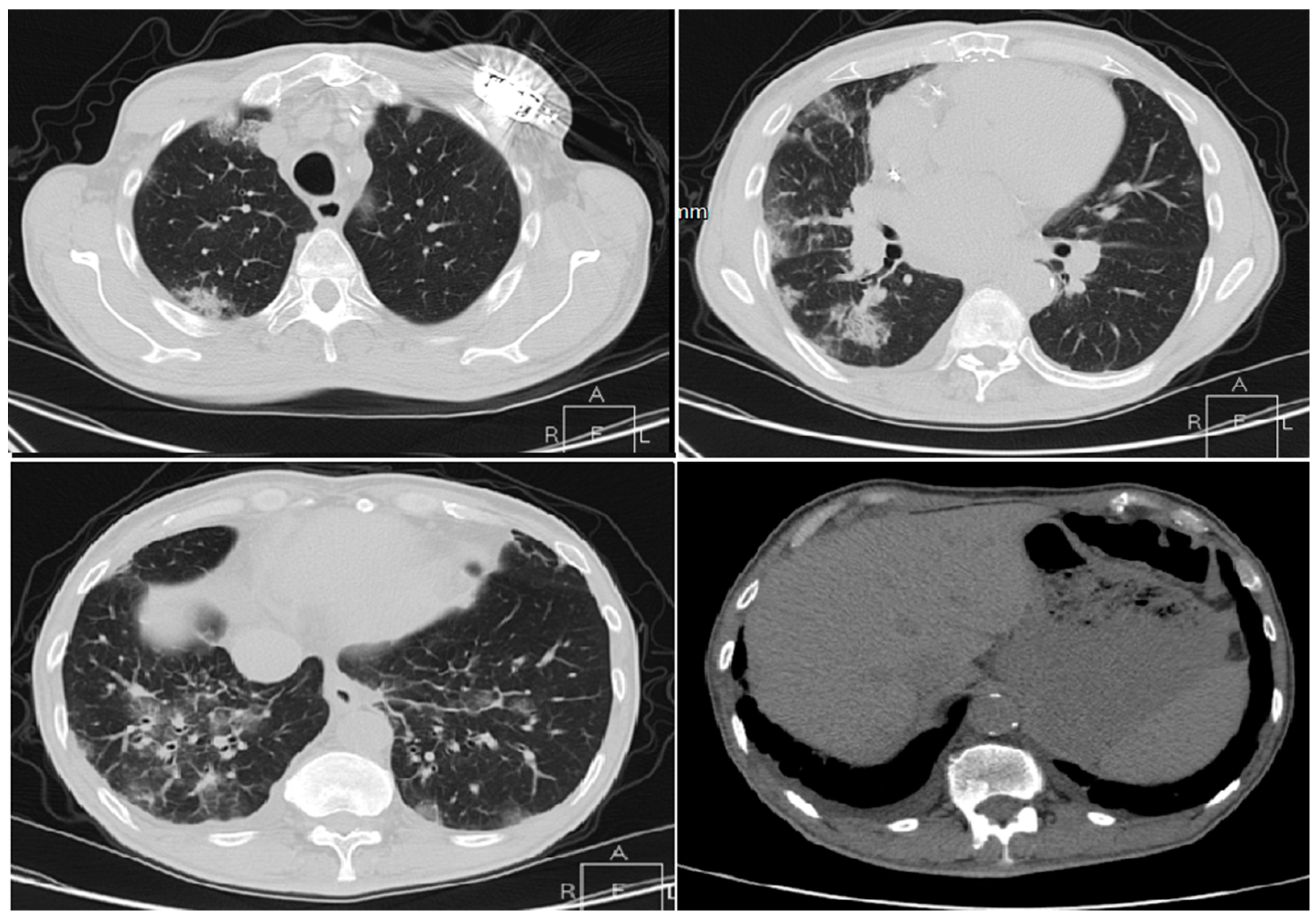 Applsci 10 03641 g008