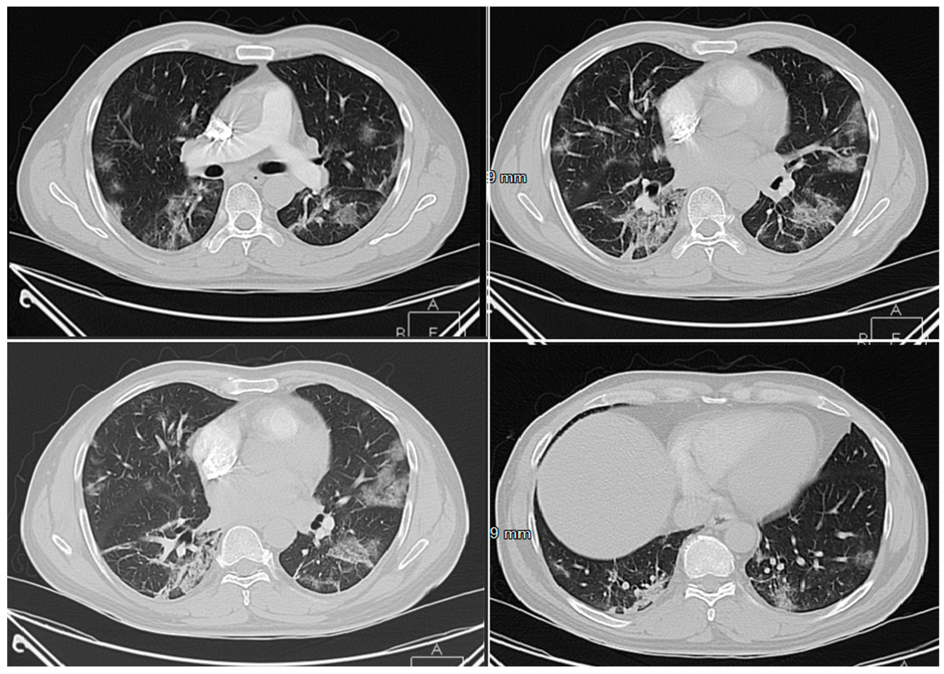 Applsci 10 03641 g009