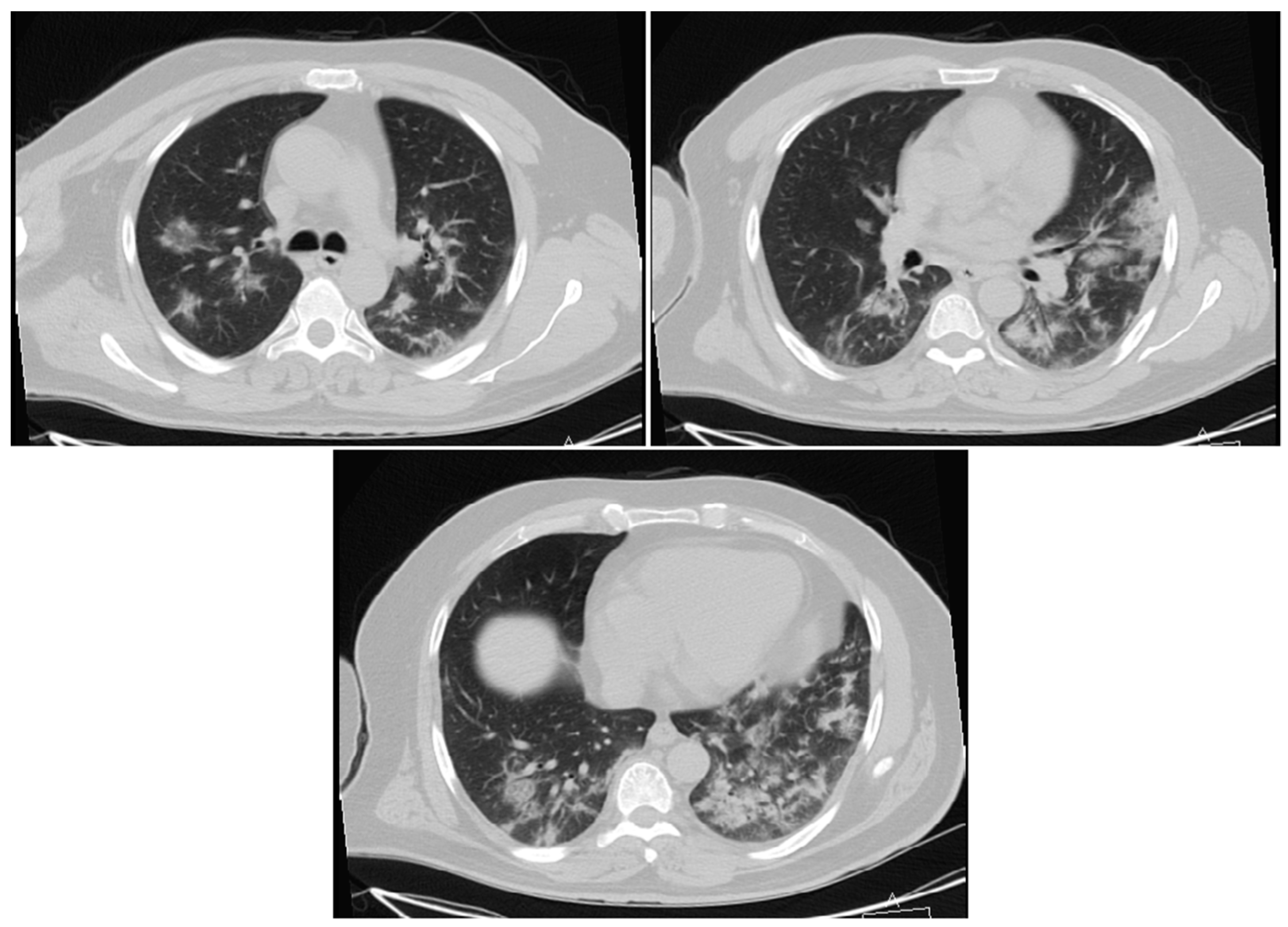 Applsci 10 03641 g010