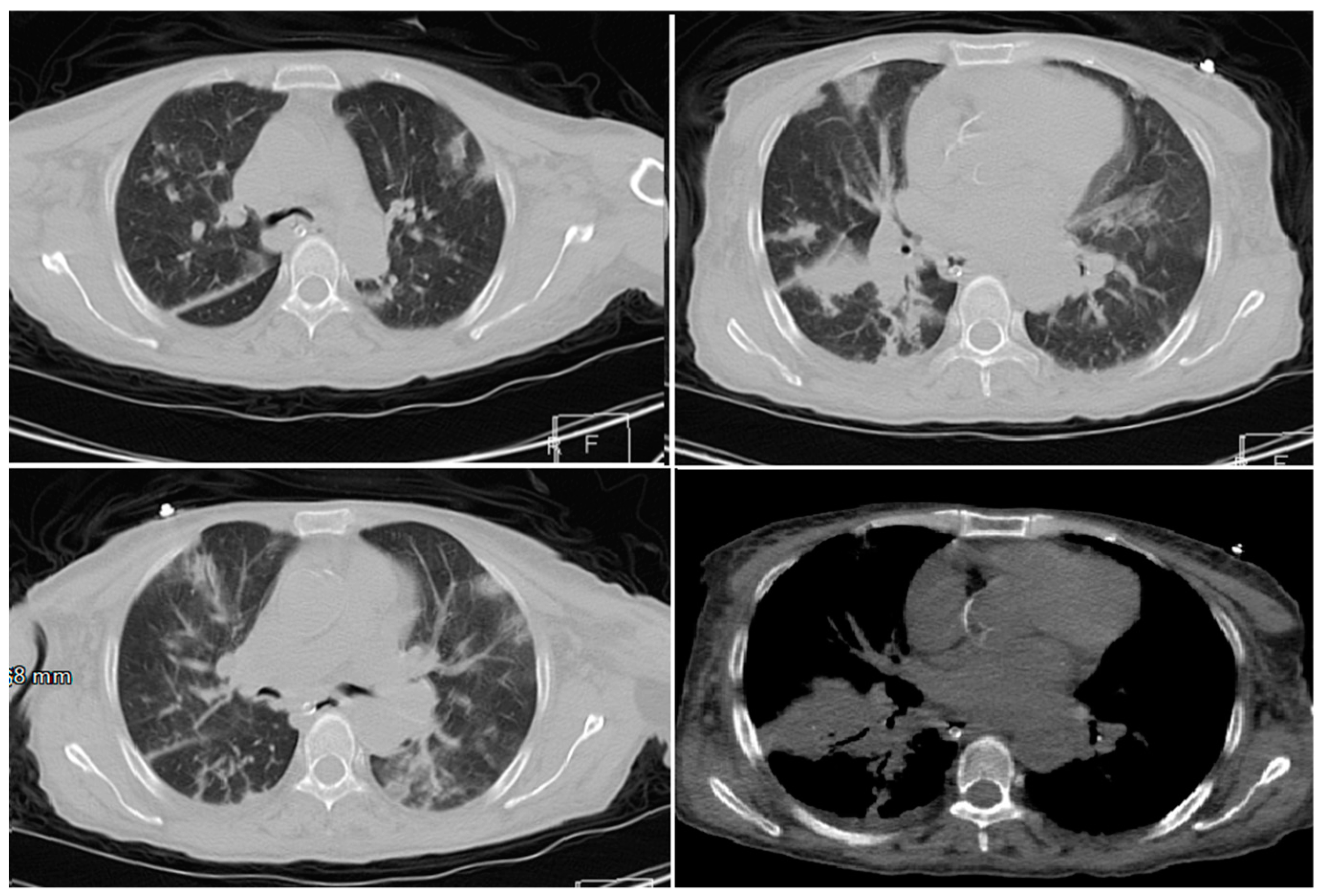 Applsci 10 03641 g011