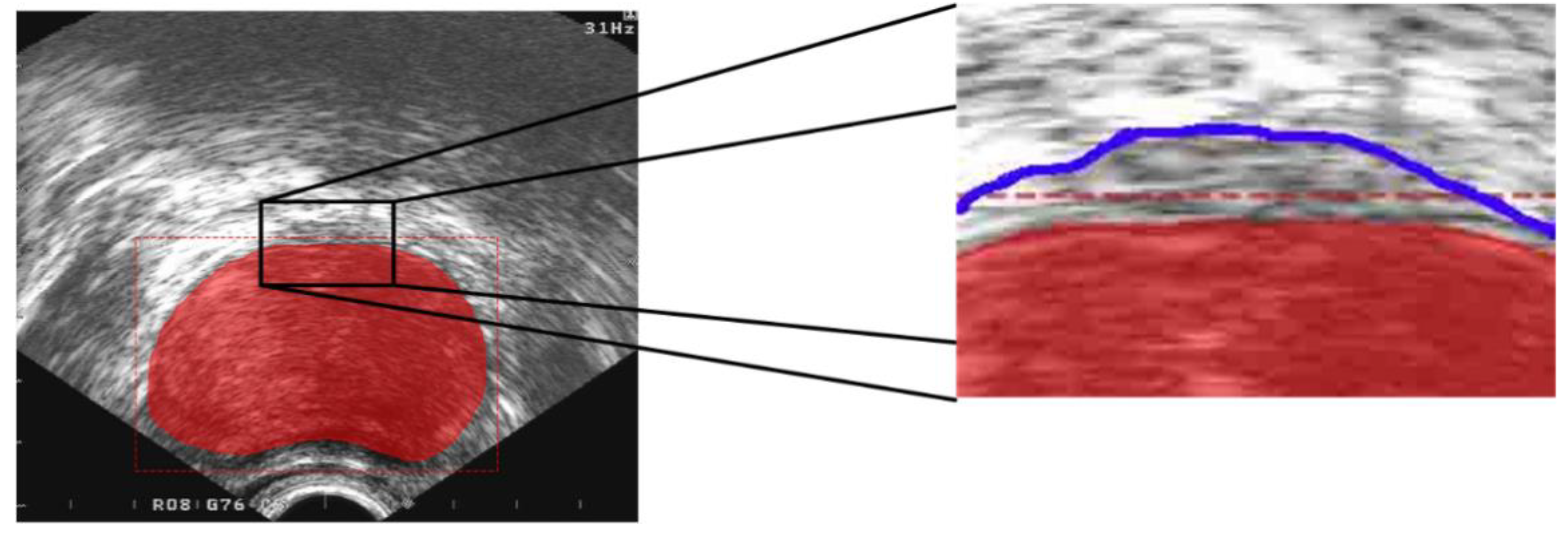 Applsci 10 03834 g005