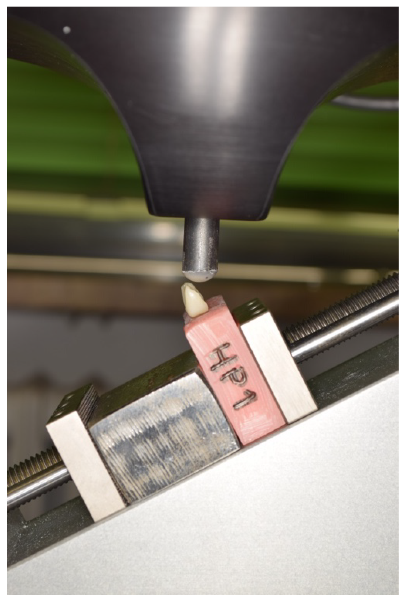 Applsci 10 04151 g005