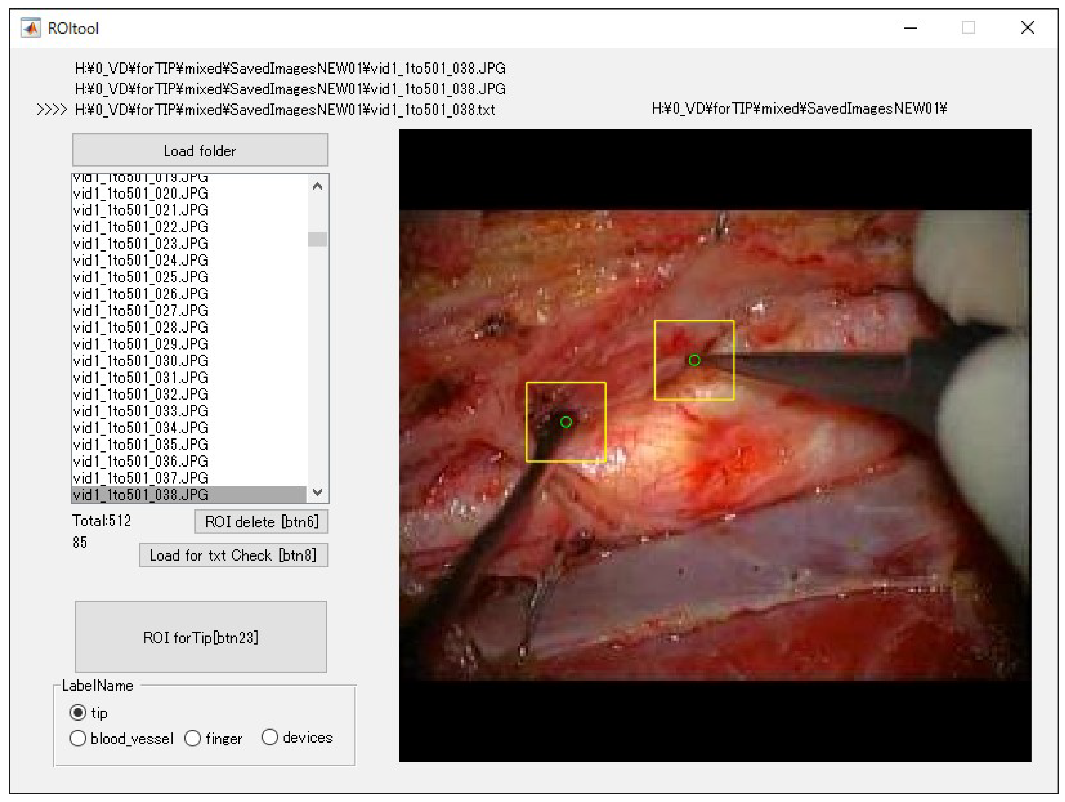 Applsci 10 04245 g003