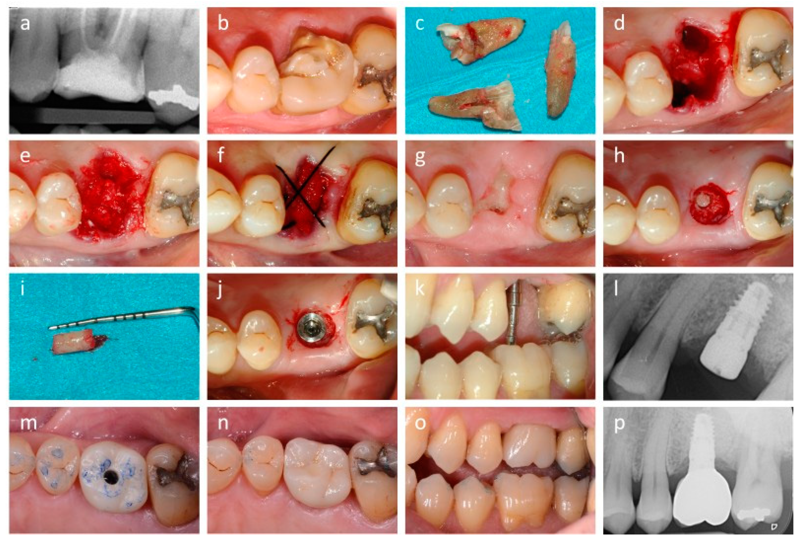 Applsci 10 04256 g002