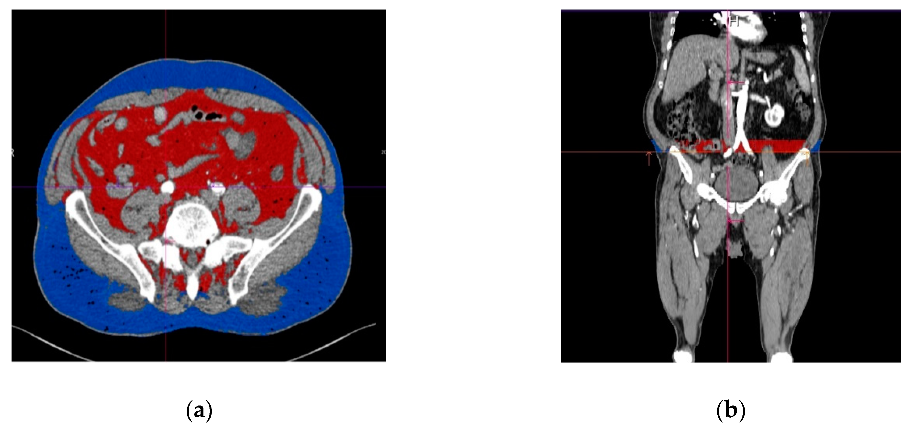 Applsci 10 04456 g003