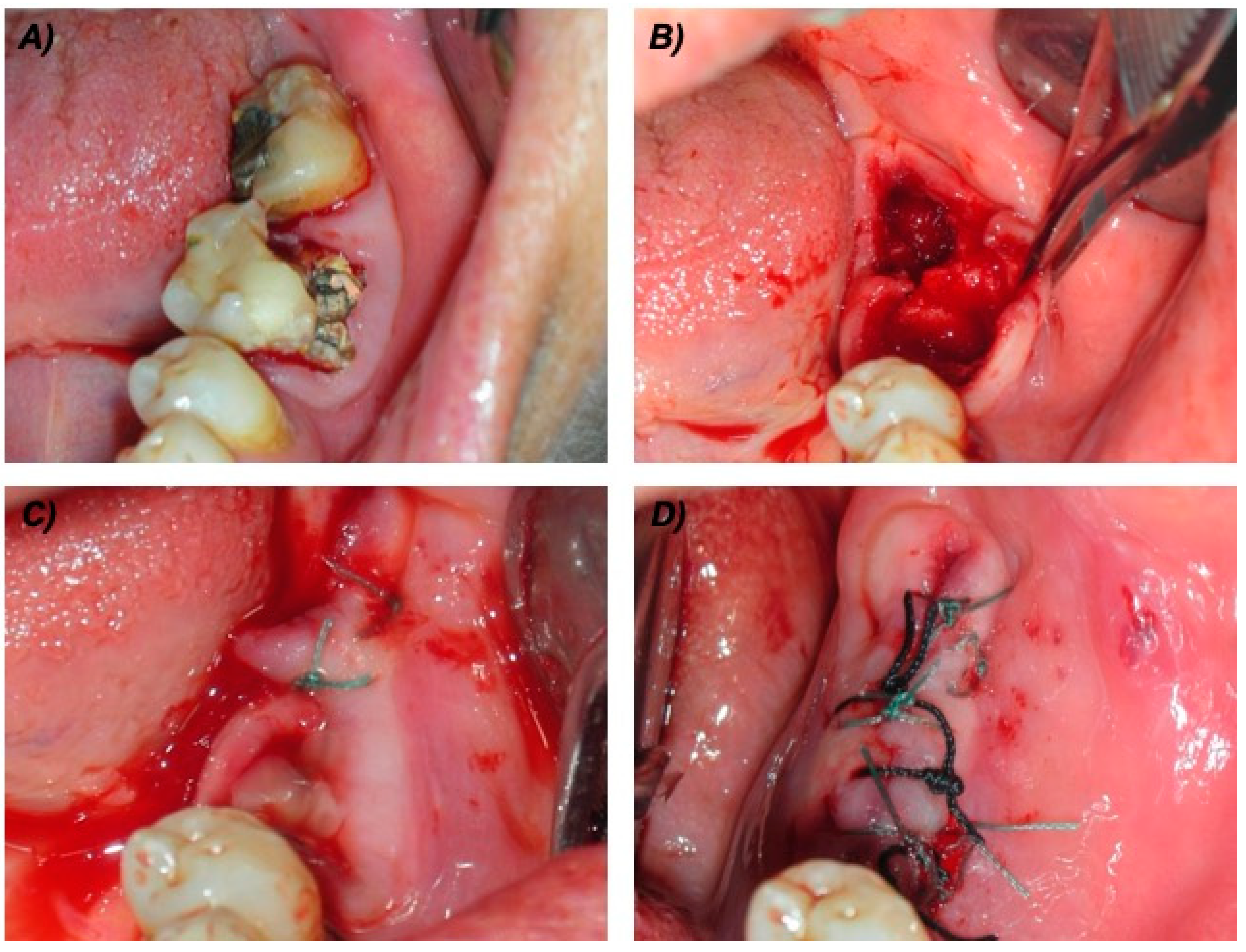 Applsci 10 04487 g001