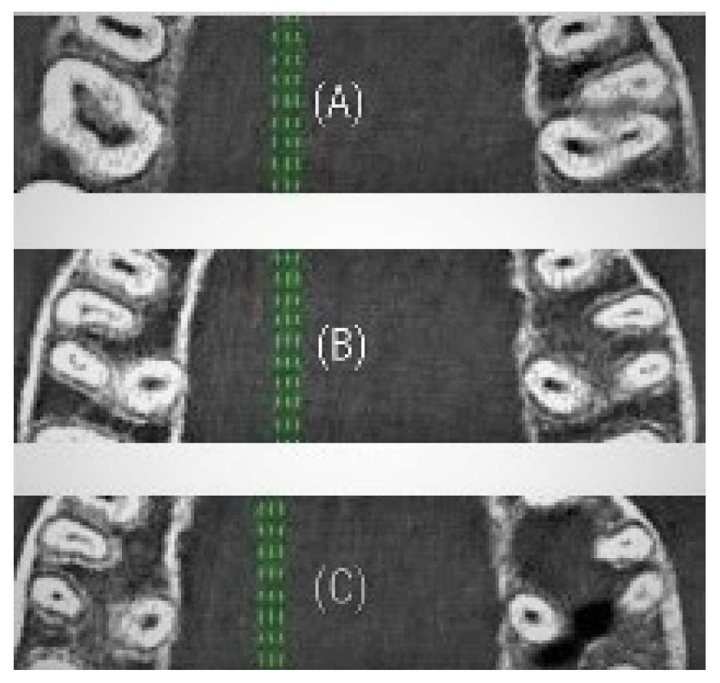 Applsci 10 04495 g004