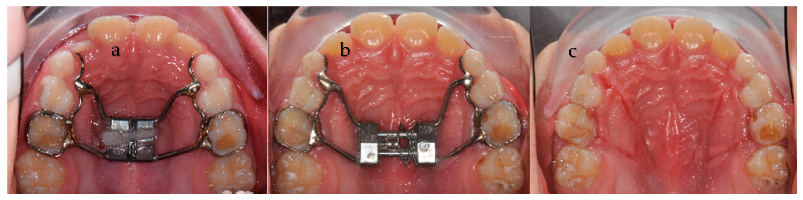 Applsci 10 04512 g001