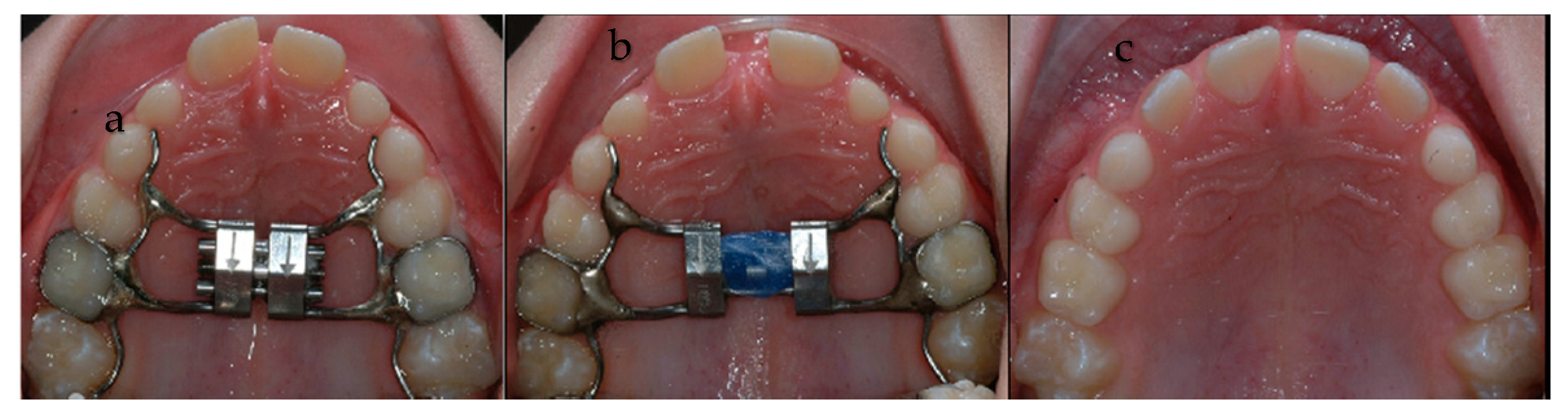 Applsci 10 04512 g002