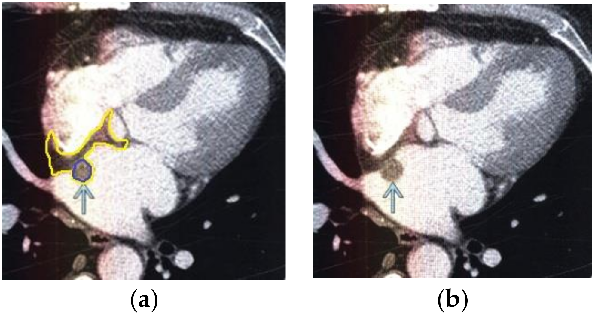 Applsci 10 04747 g005