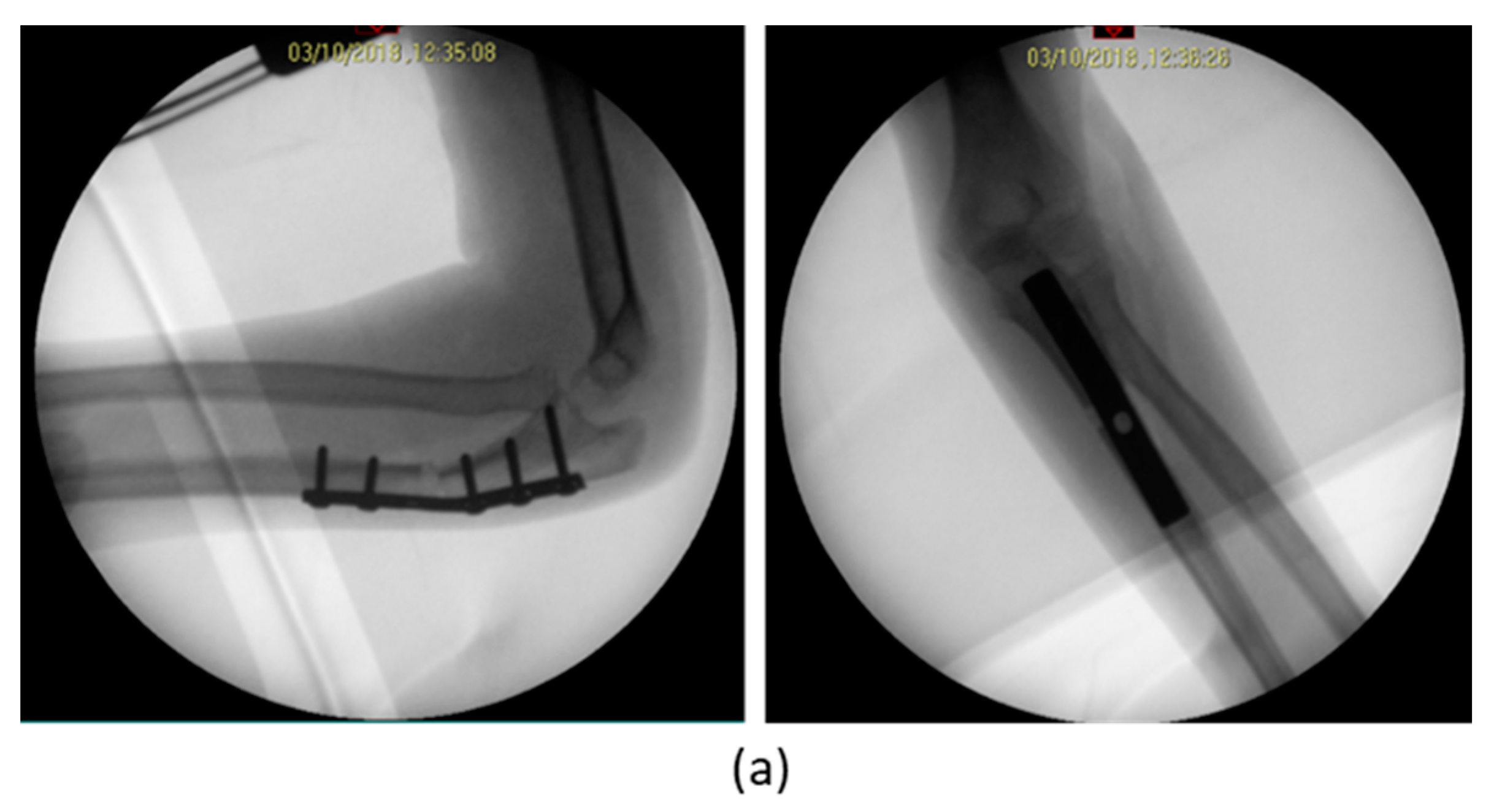 Applsci 10 05181 g007a