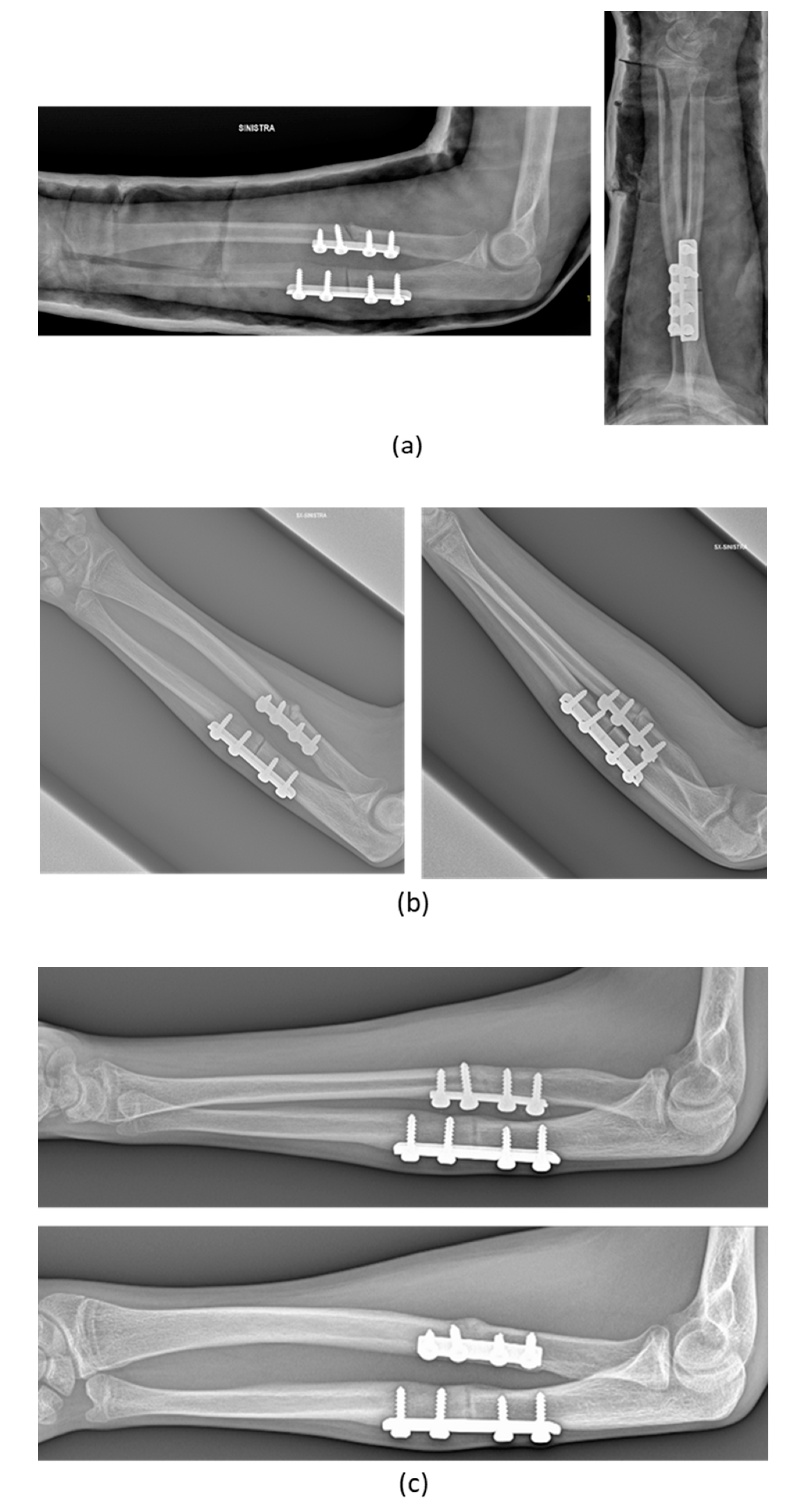 Applsci 10 05181 g011