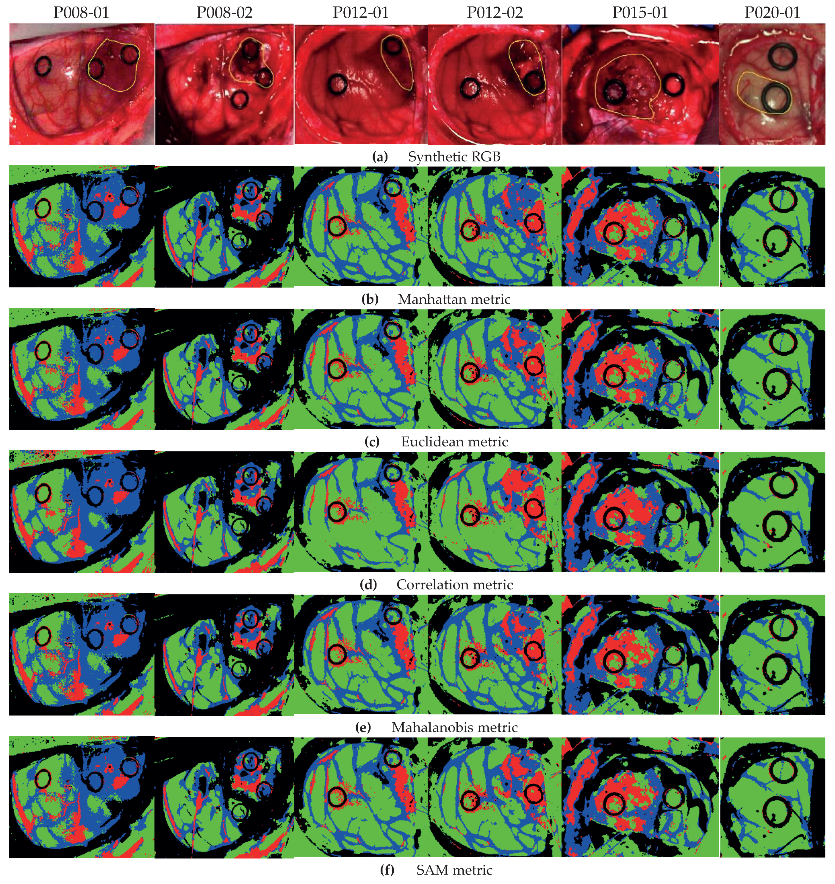 Applsci 10 05686 g005