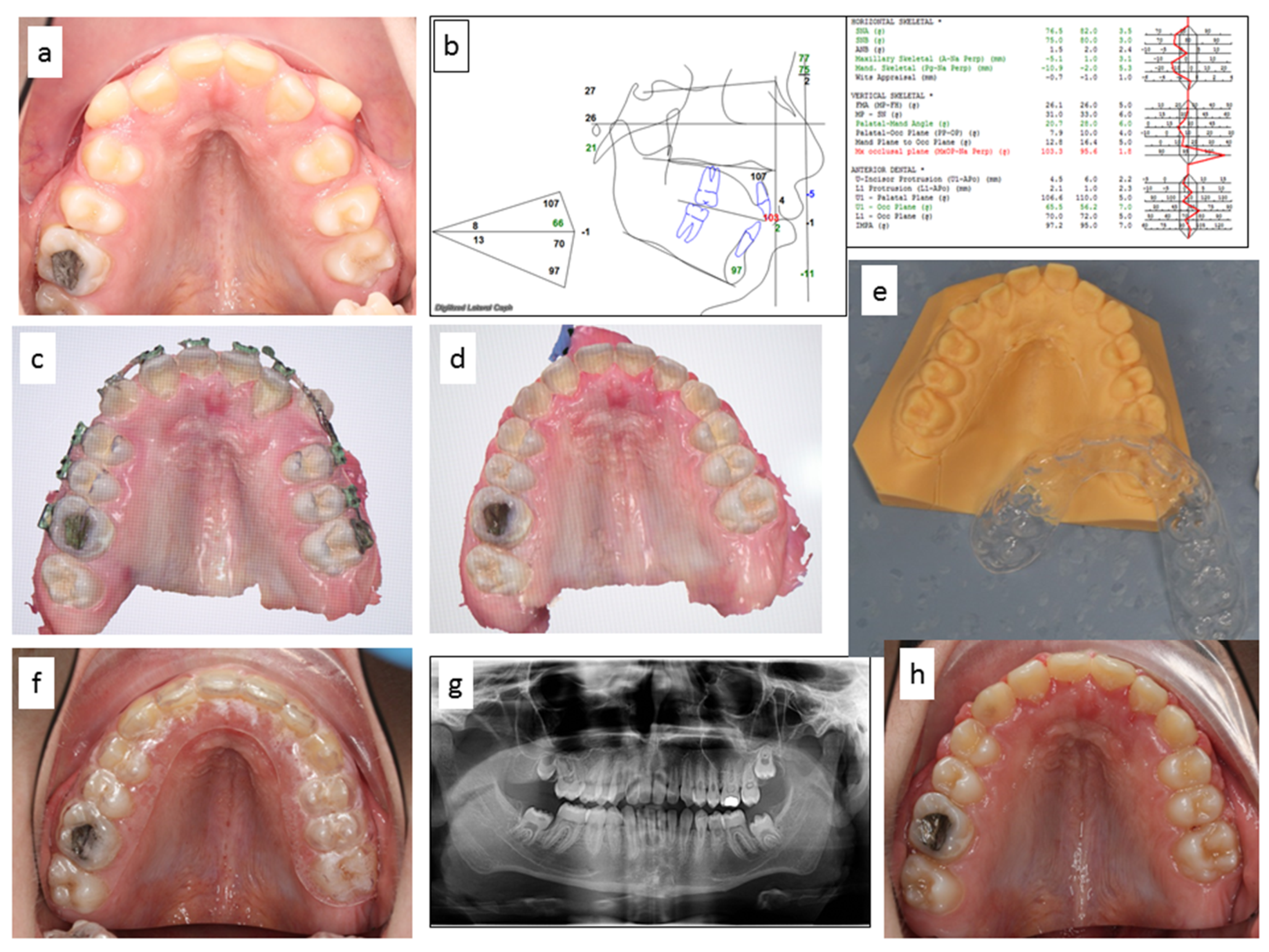 Applsci 10 05708 g004 Applsci 10 05708 g004