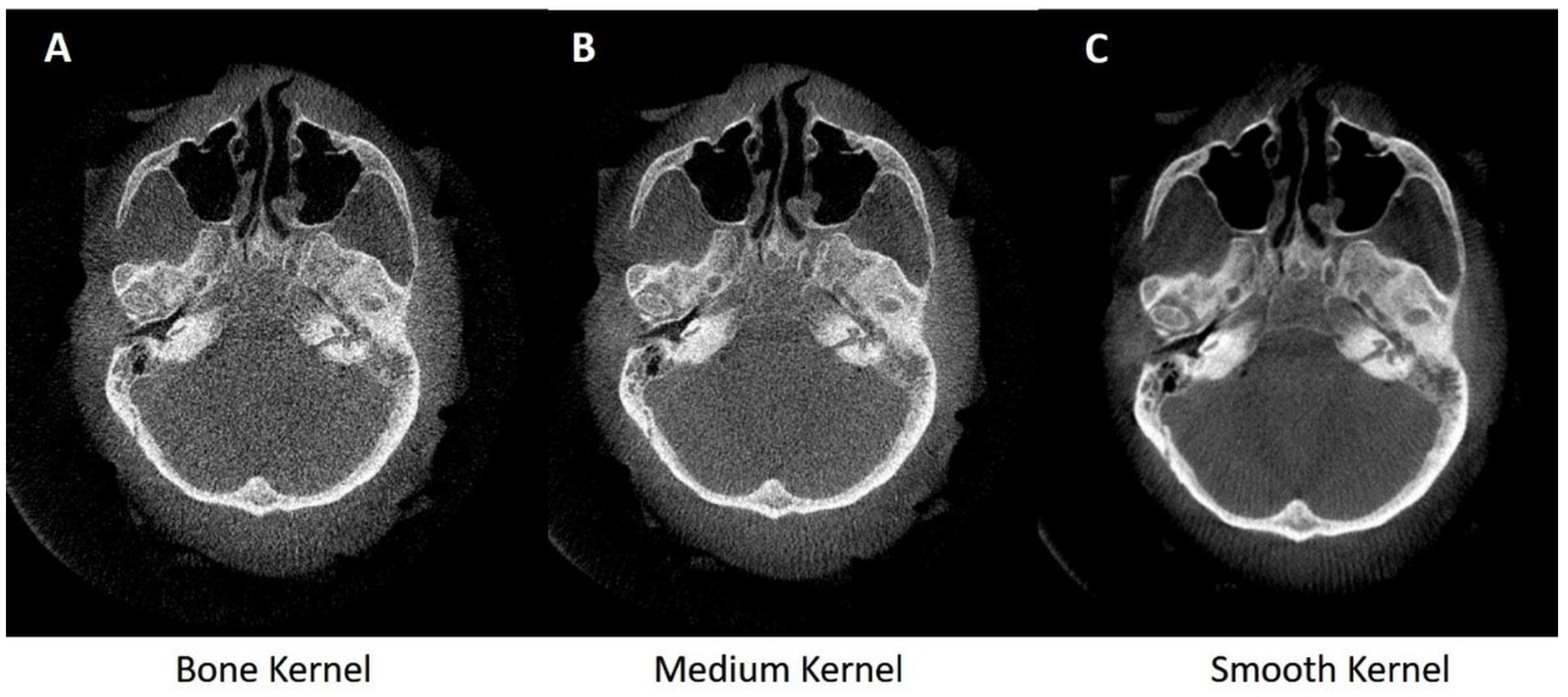 Applsci 10 05876 g003