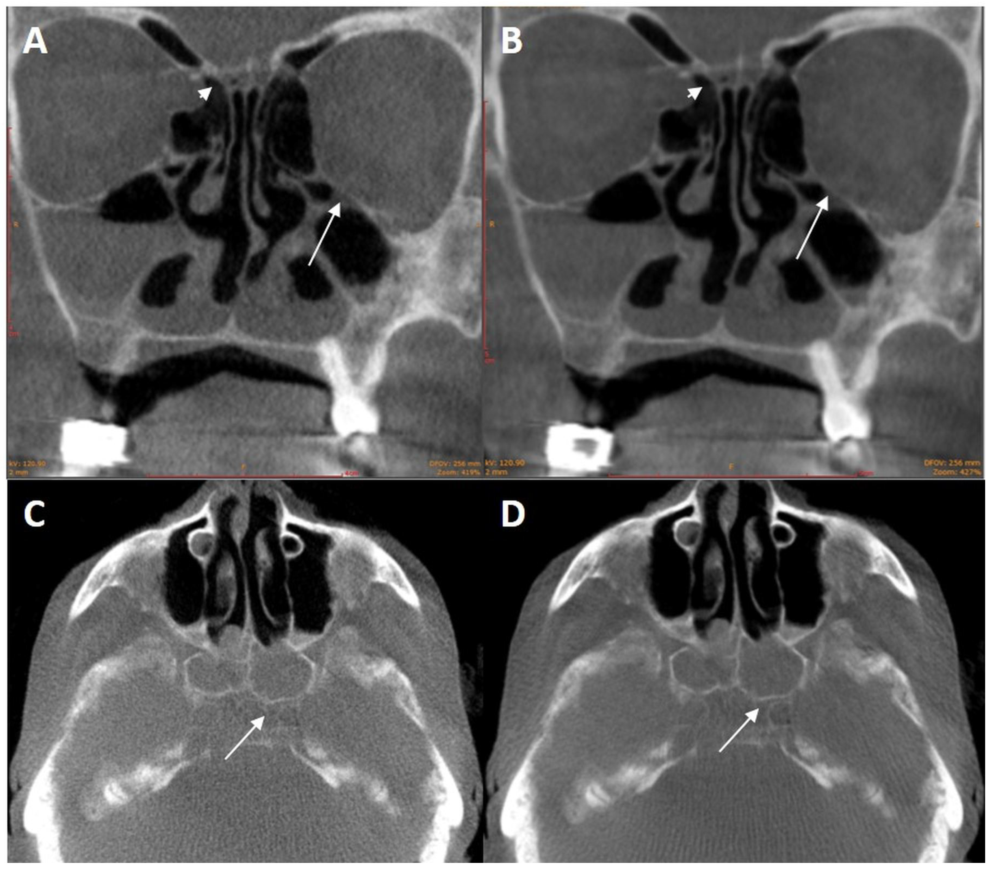 Applsci 10 05876 g006