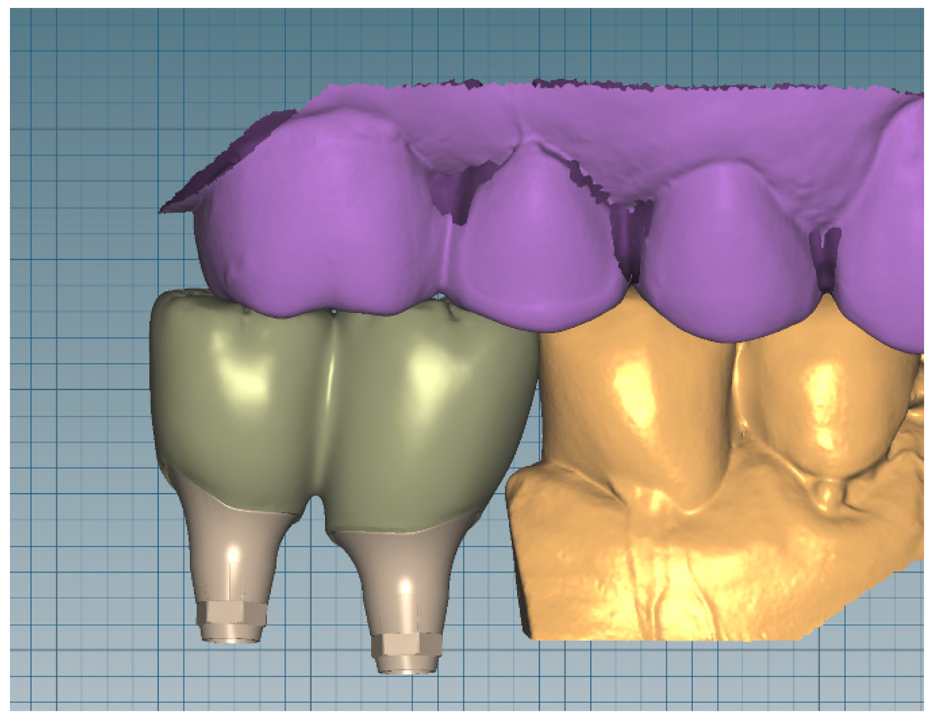 Applsci 10 07735 g001