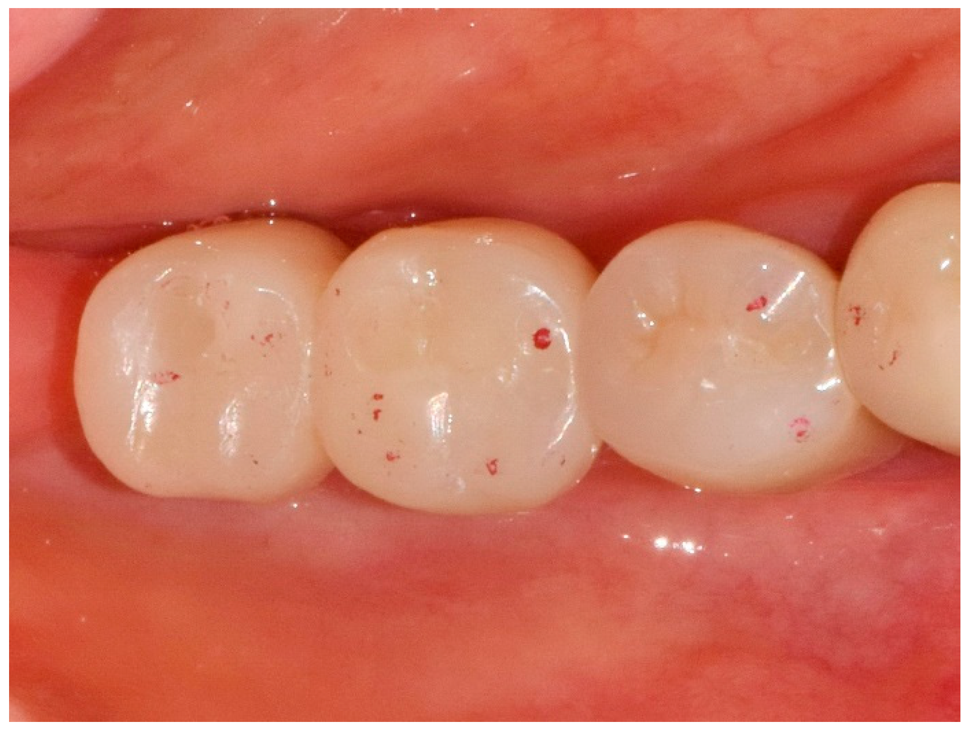 Applsci 10 07735 g005