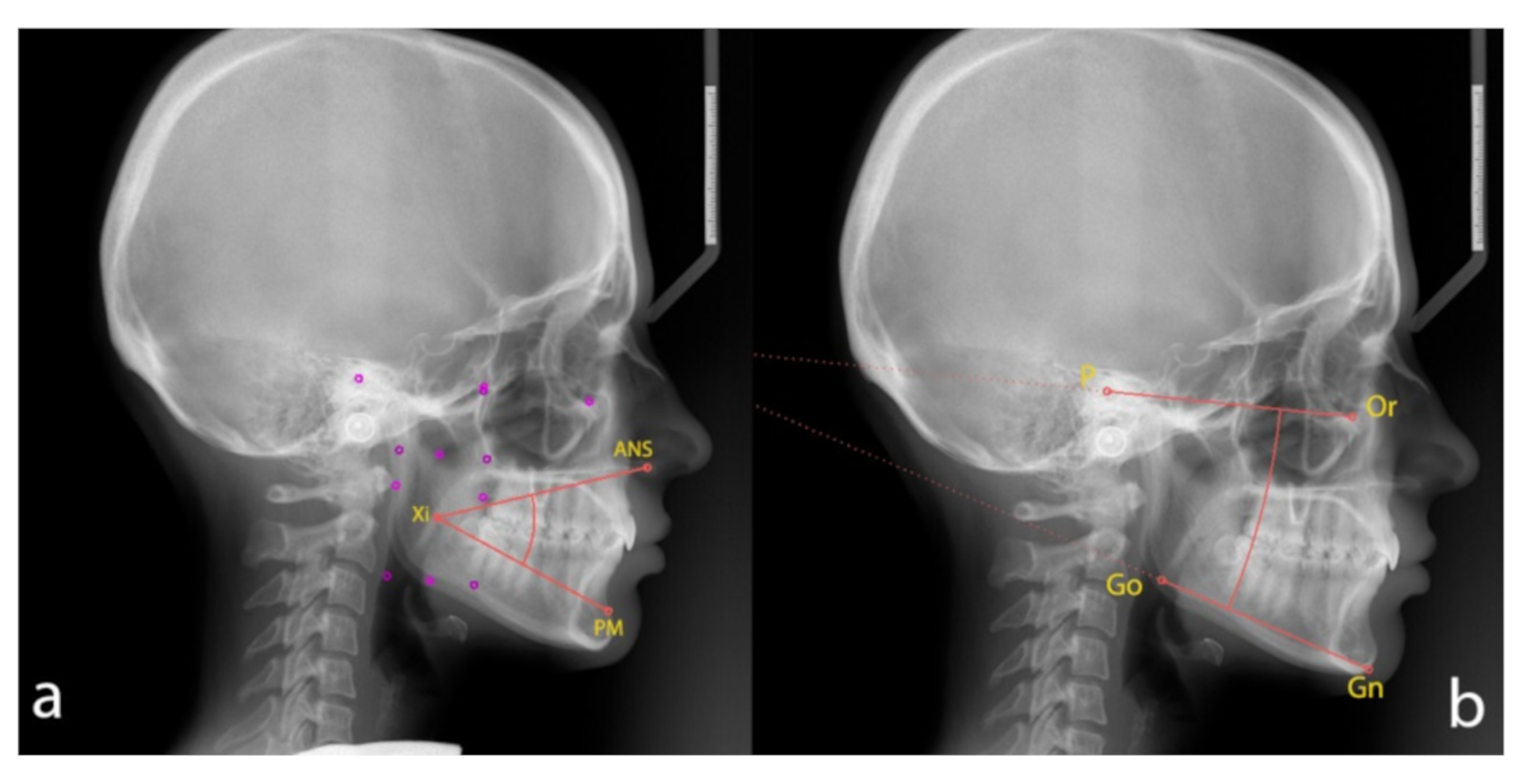 Applsci 10 07890 g001