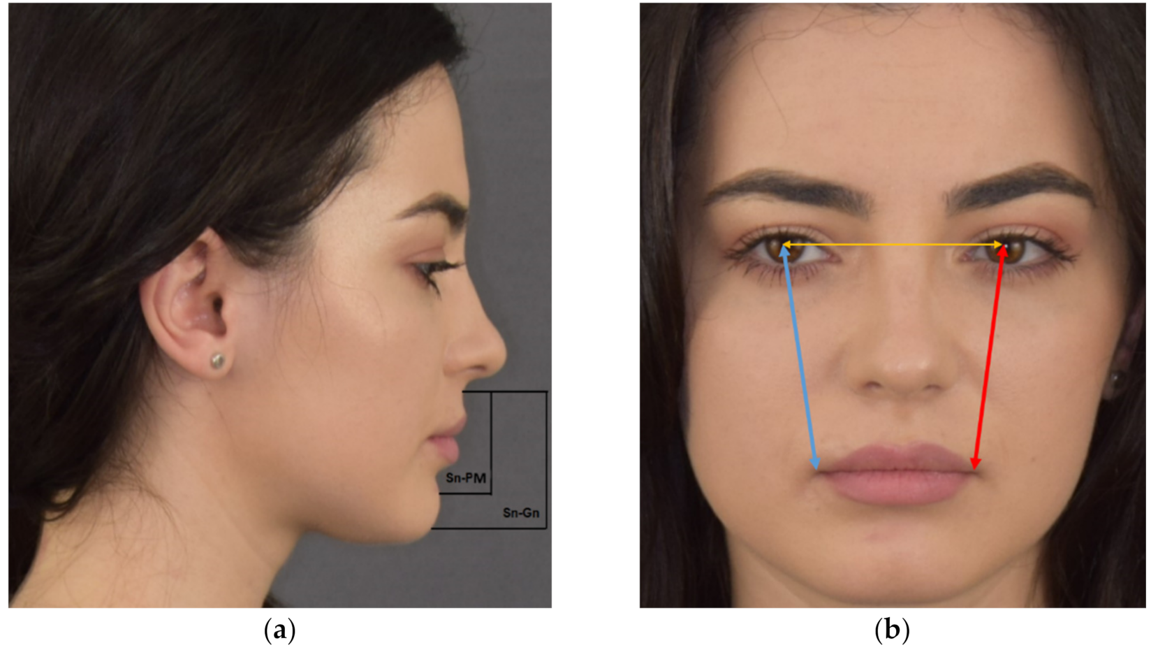 Applsci 10 07890 g002