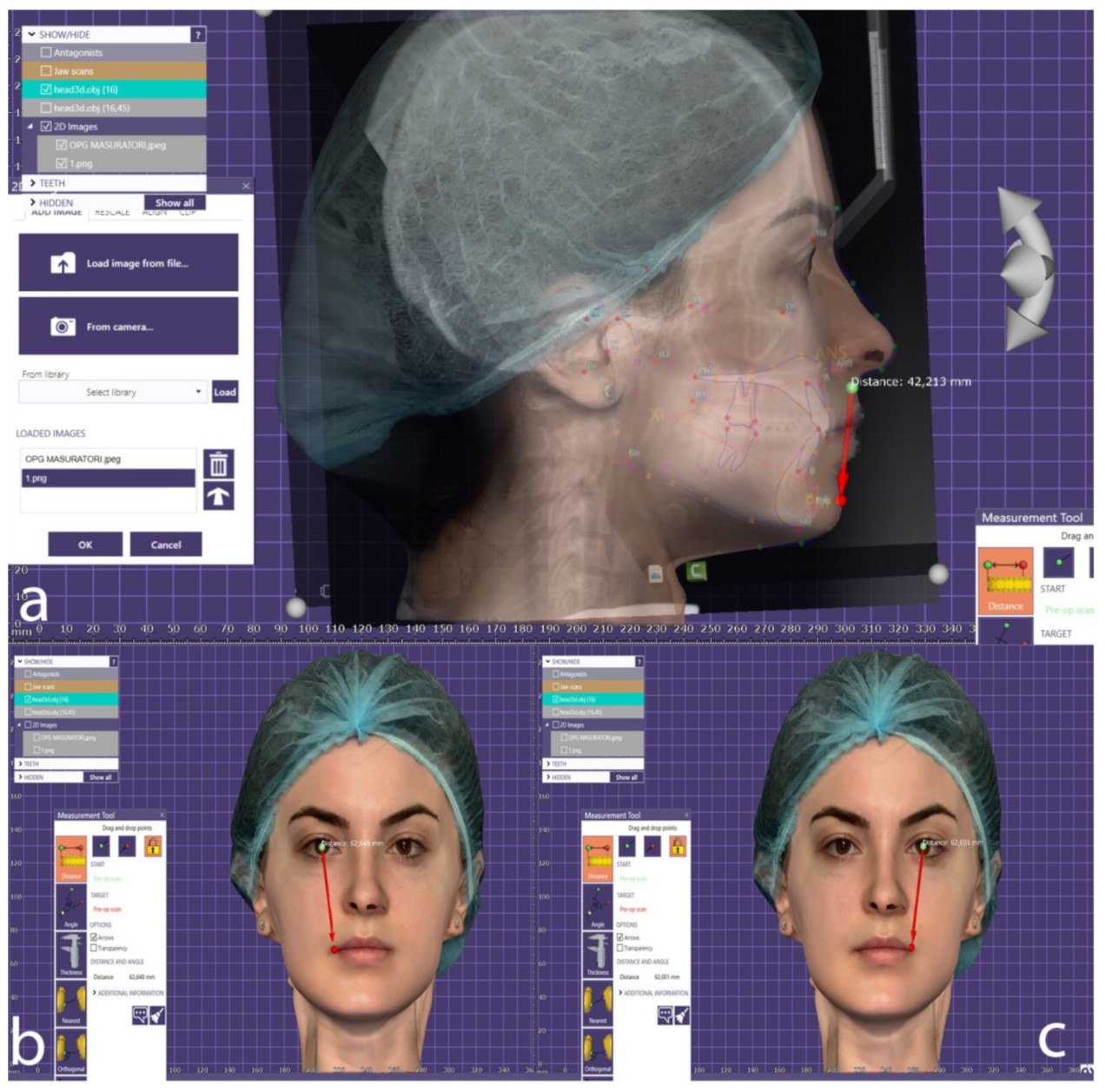 Applsci 10 07890 g004