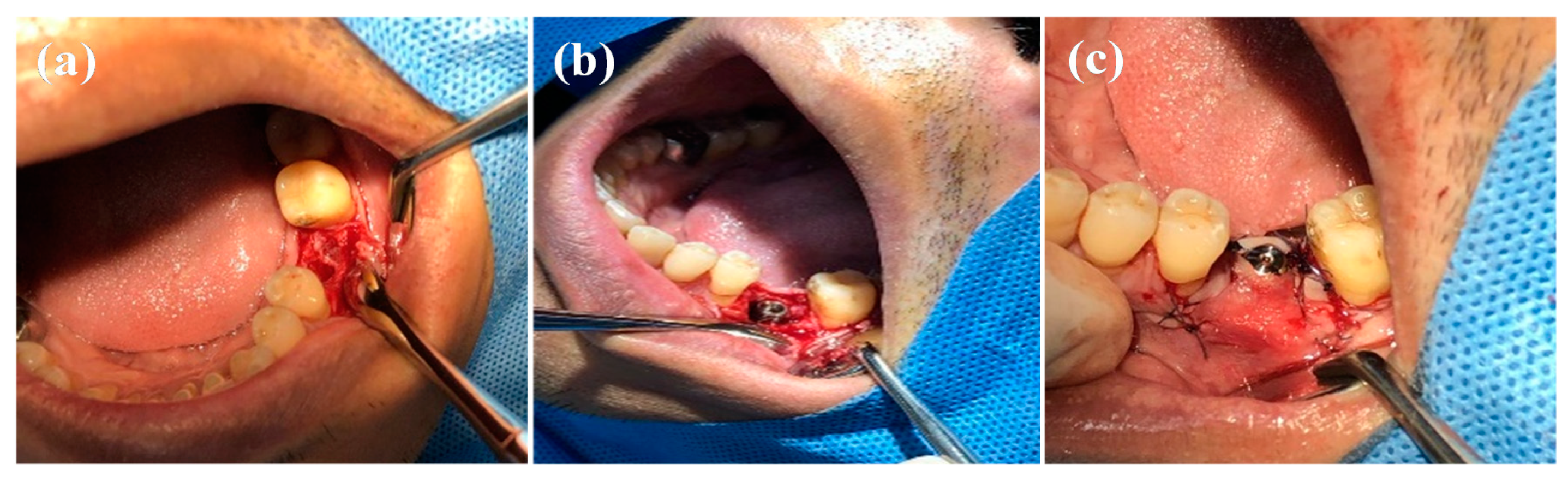 Applsci 10 08582 g002